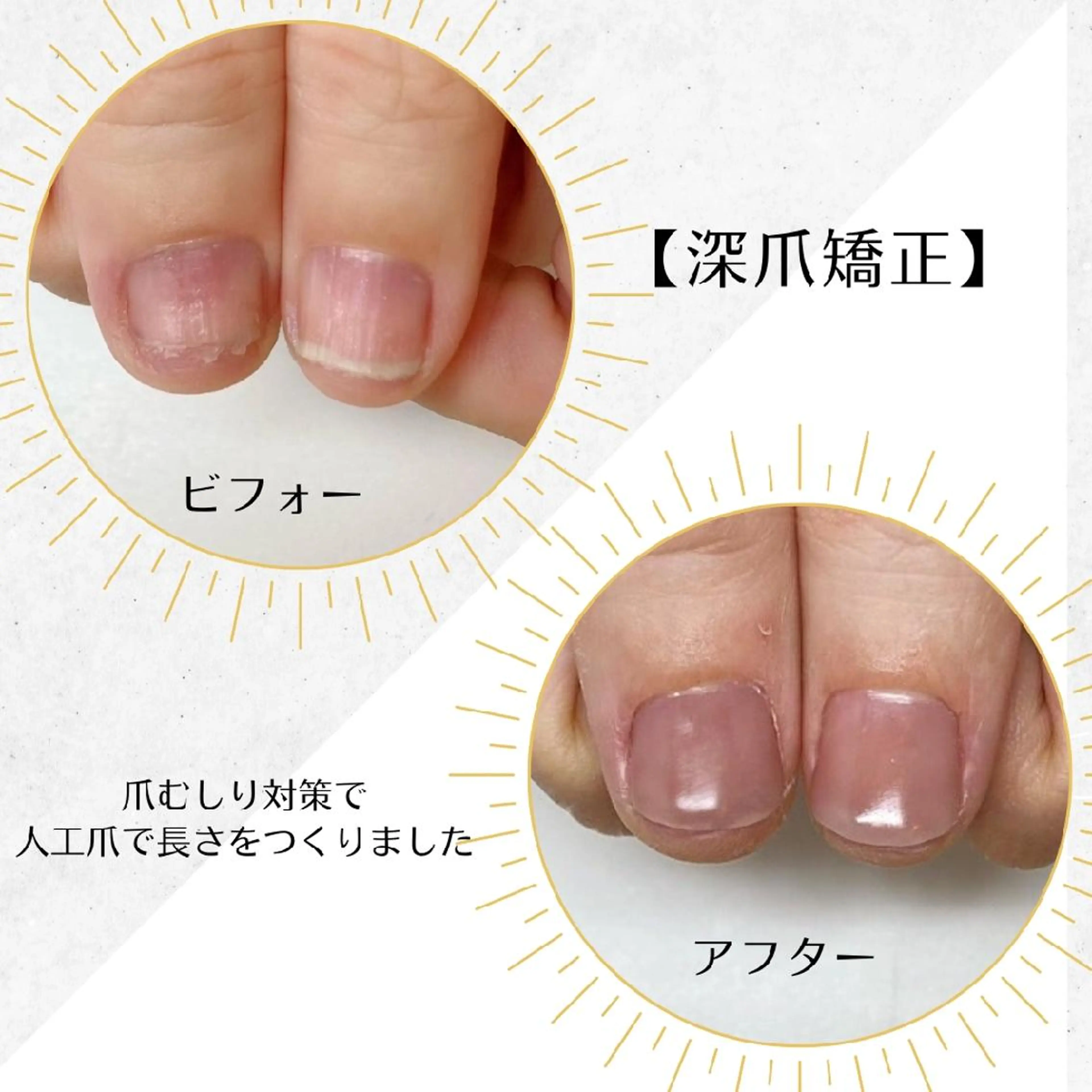 ネイル ネイルサロン アリュームのネイルデザイン