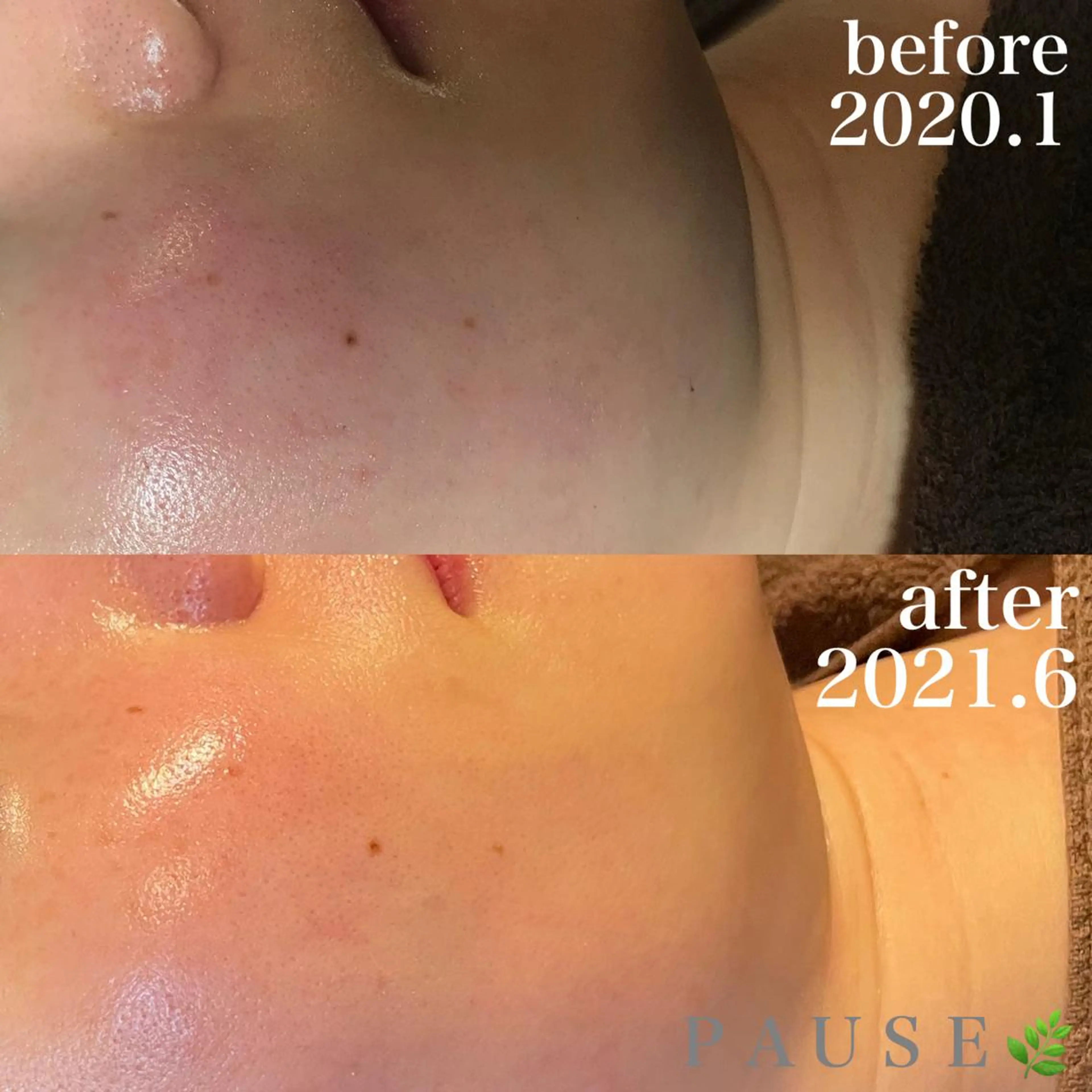 エステ 浜野 恵美のエステ・リラクイメージ