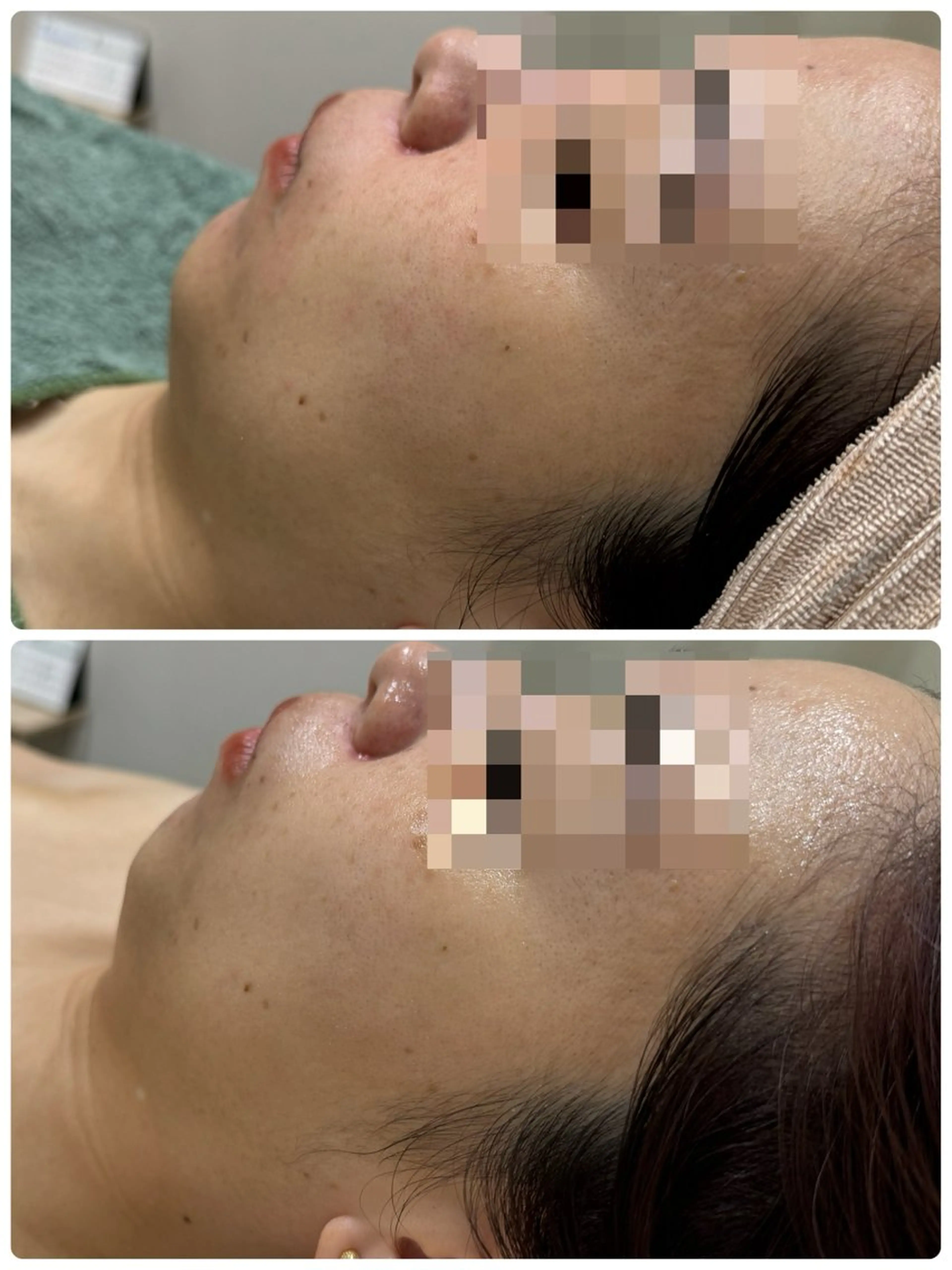 エステ 脱毛&フェイシャル 専門店muro.のエステ・リラクイメージ