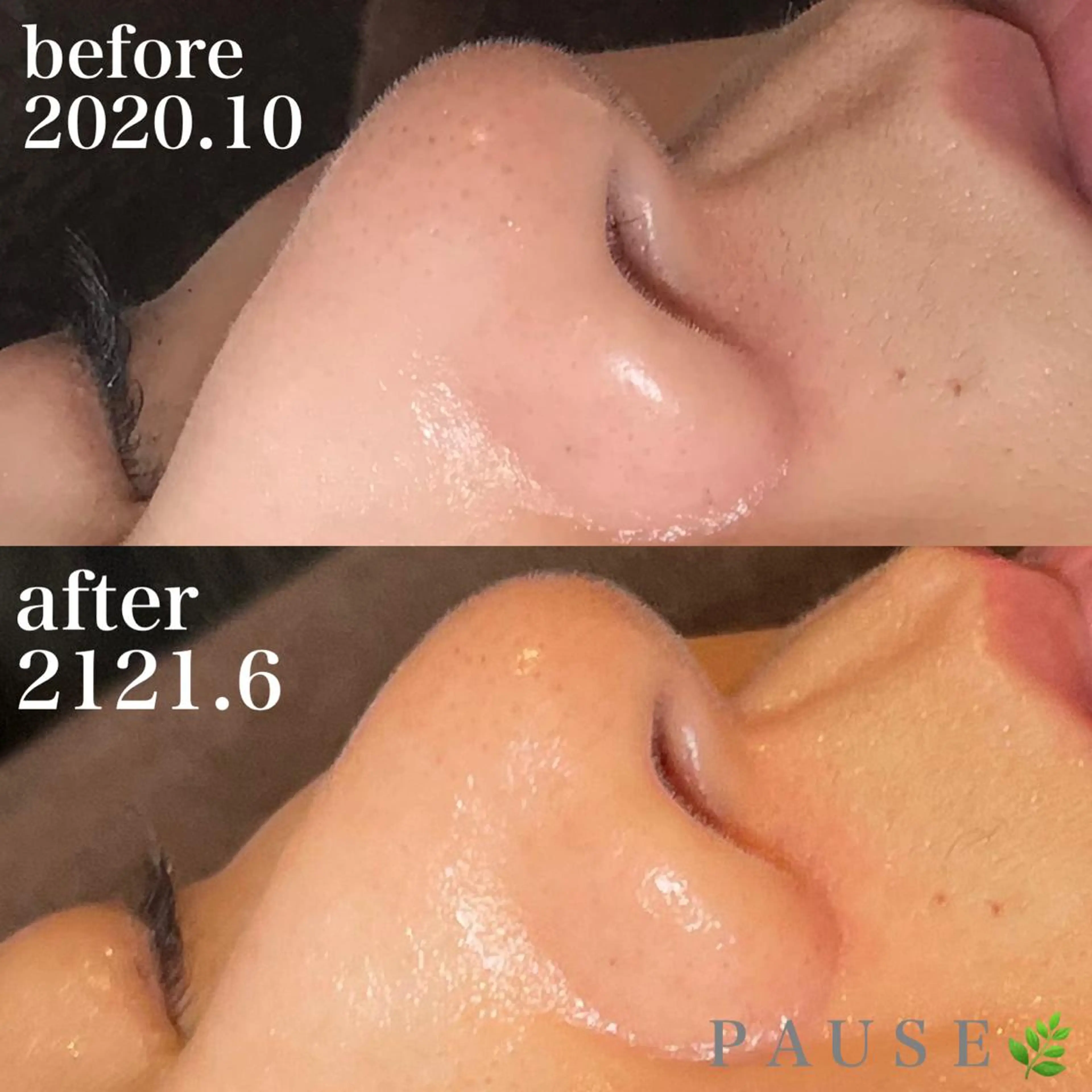 エステ 浜野 恵美のエステ・リラクイメージ