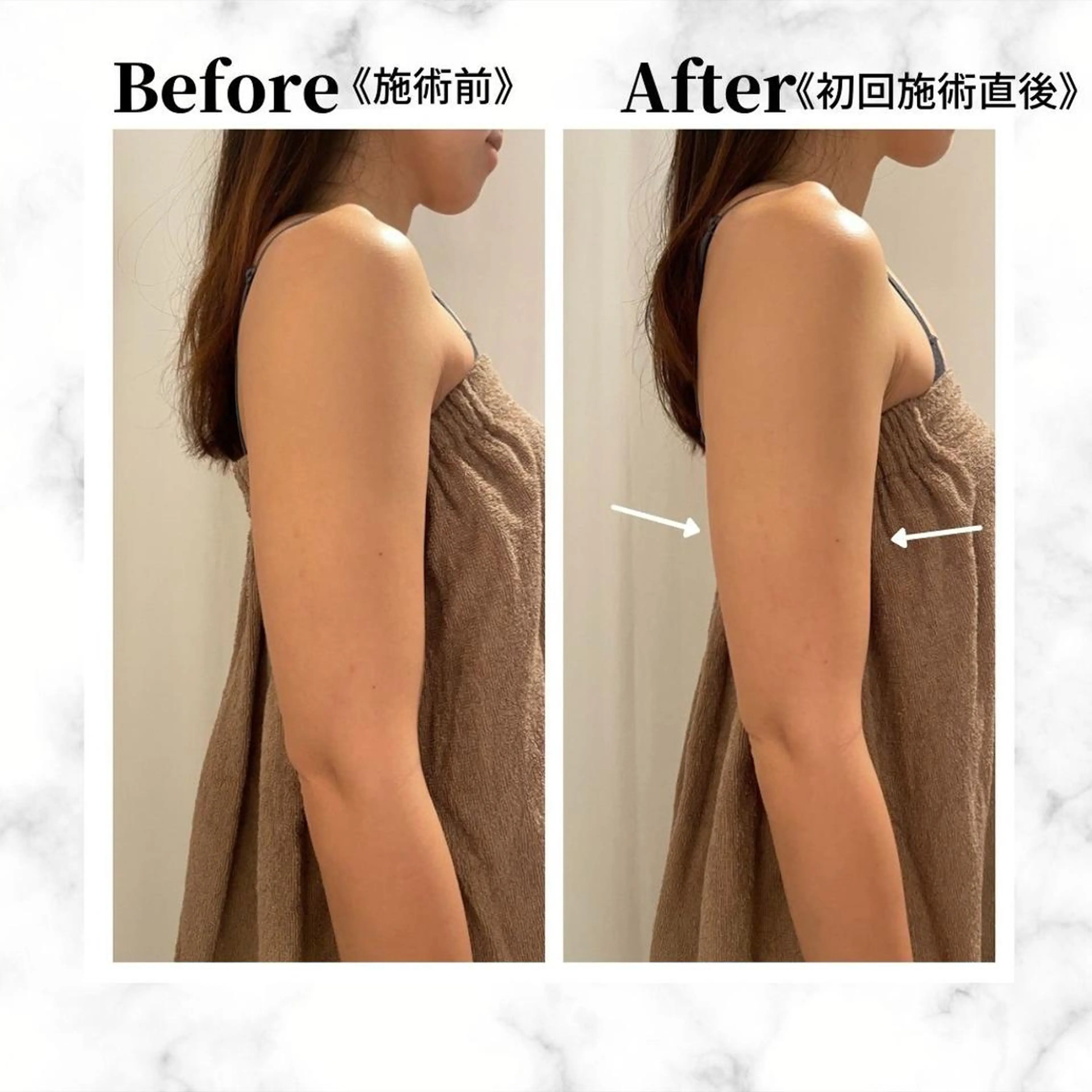 12Dハイフ💗 最強小顔のエステ・リラクイメージ