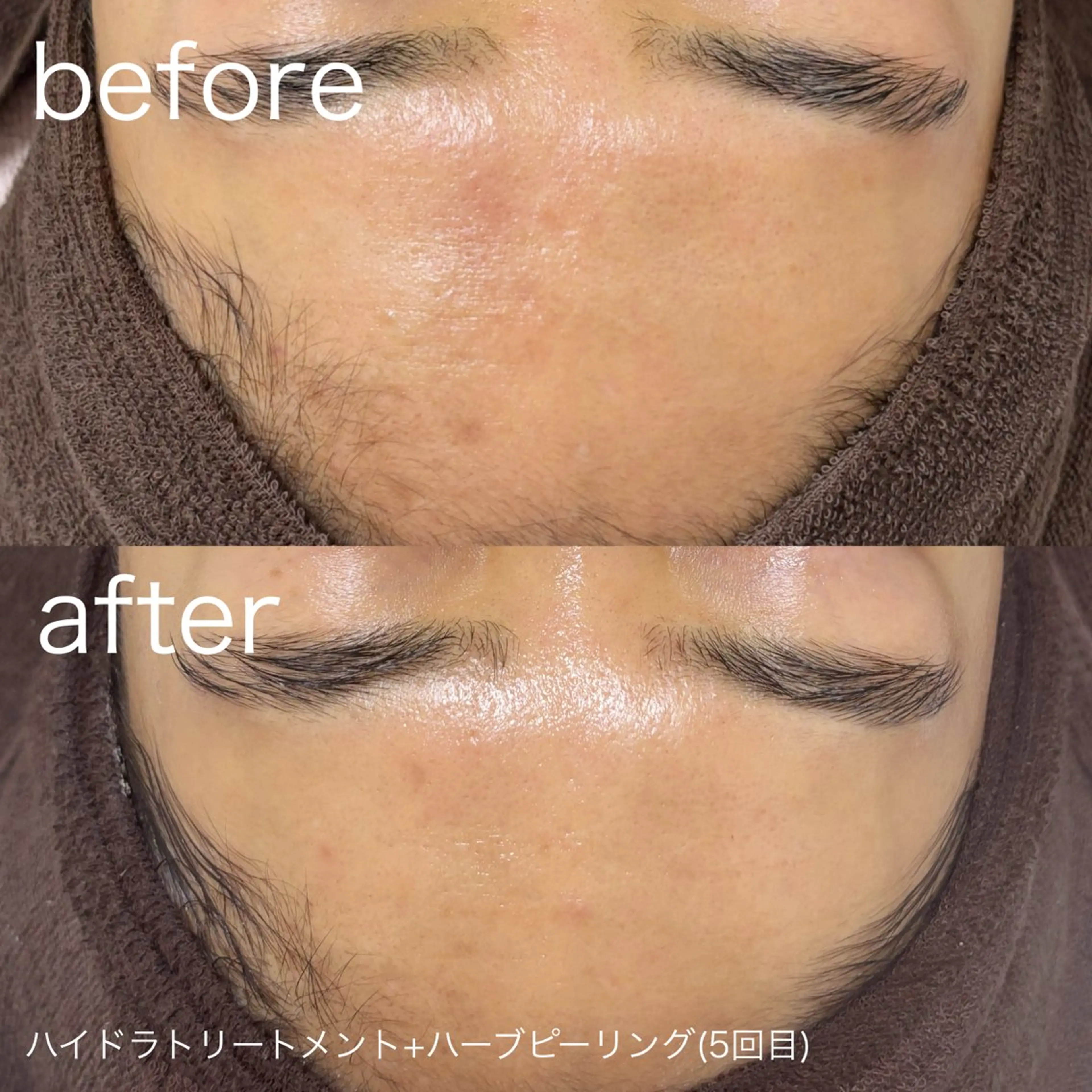 脱毛 lulularico Yuのエステ・リラクイメージ