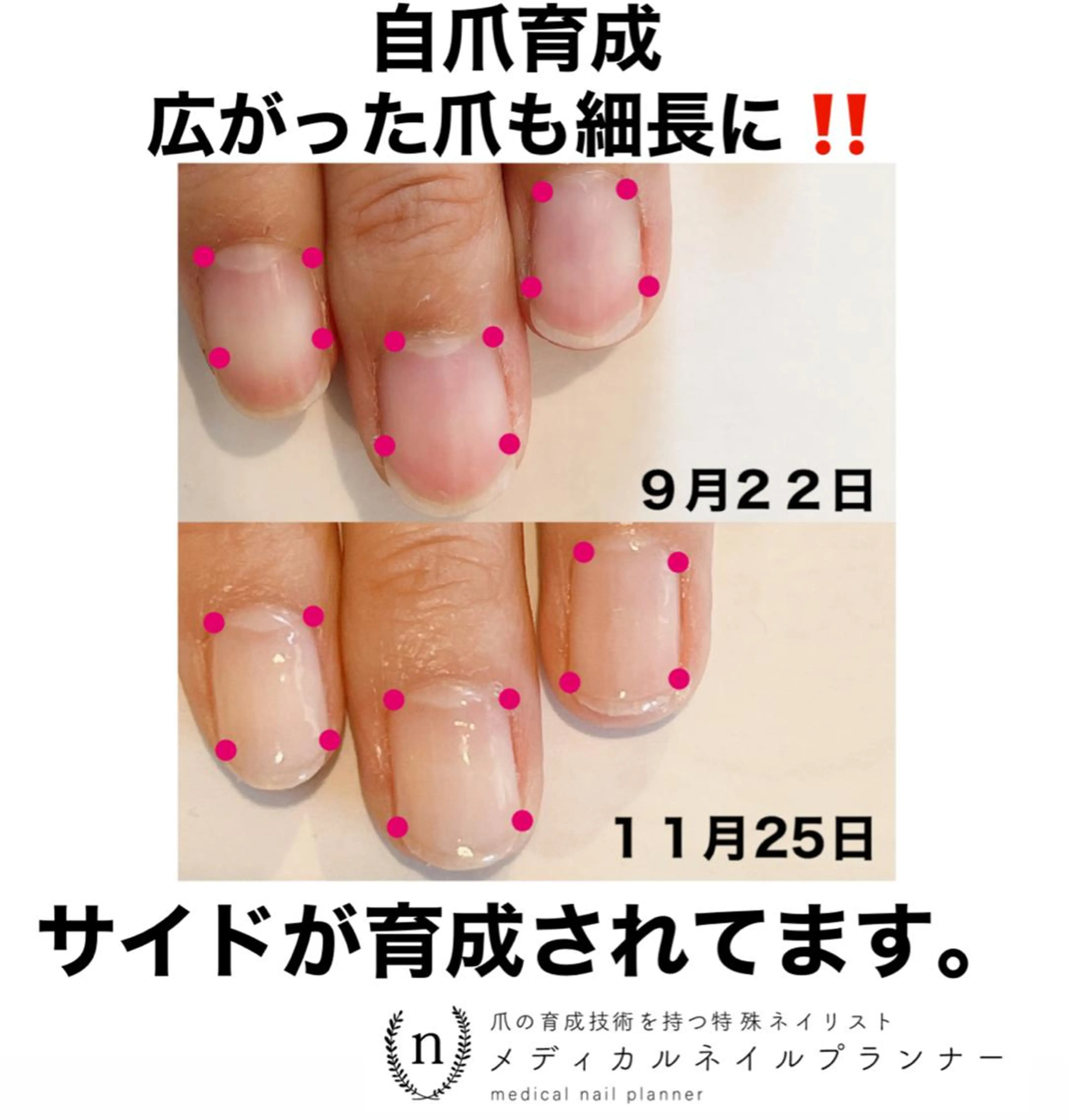 ネイル NAIL SALON ｔｏｇｇｙのネイルデザイン