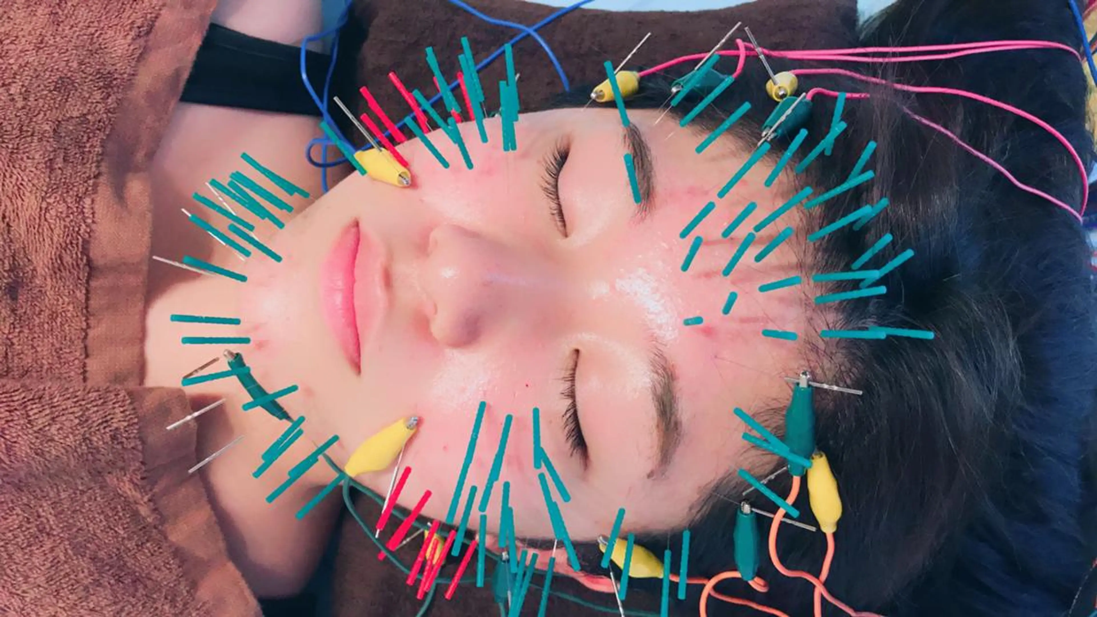 はりすたいる 鍼灸院のエステ・リラクイメージ