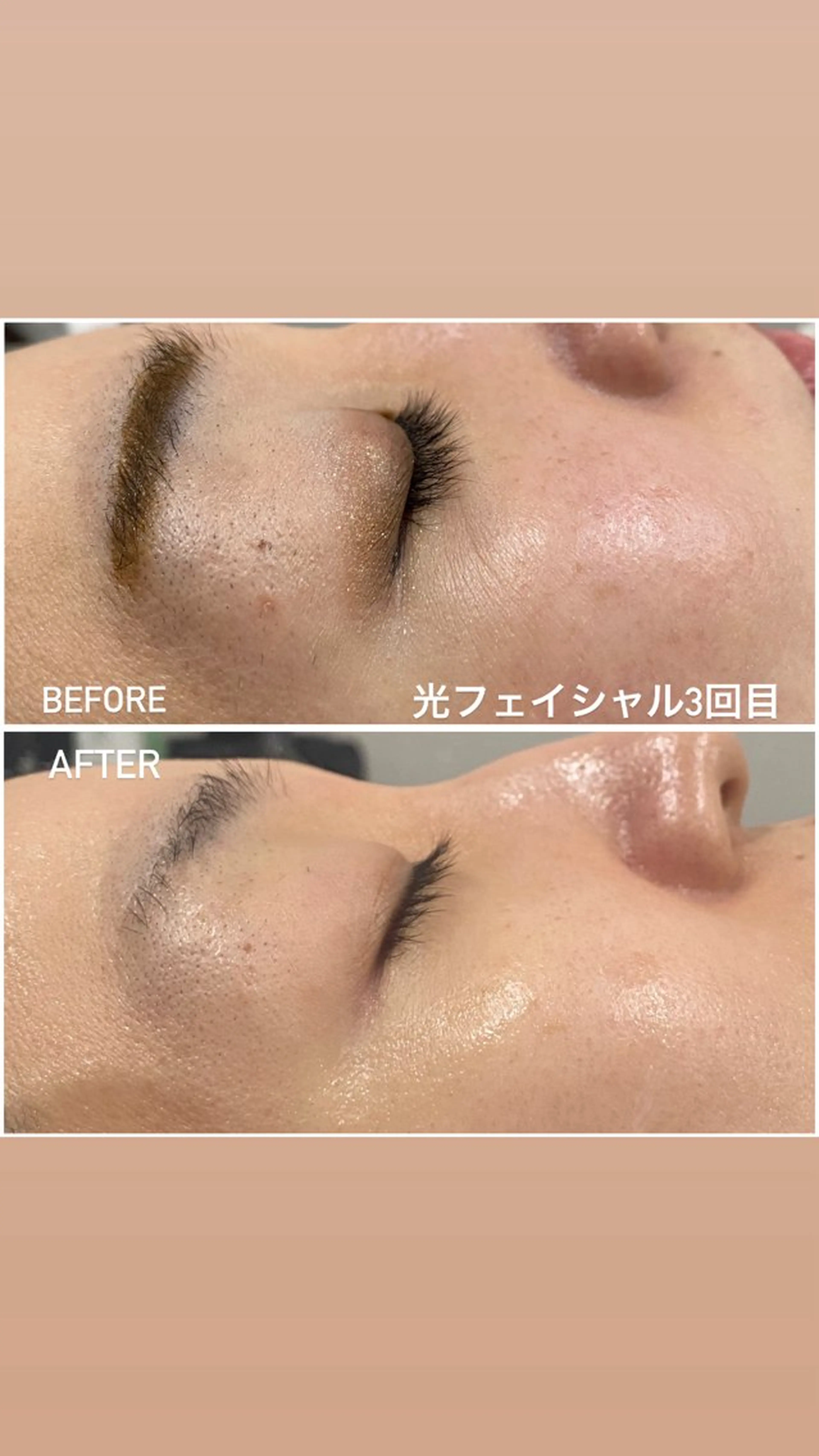 その他 毛穴洗浄・痩身・脱毛 /アルカンジュのエステ・リラクイメージ