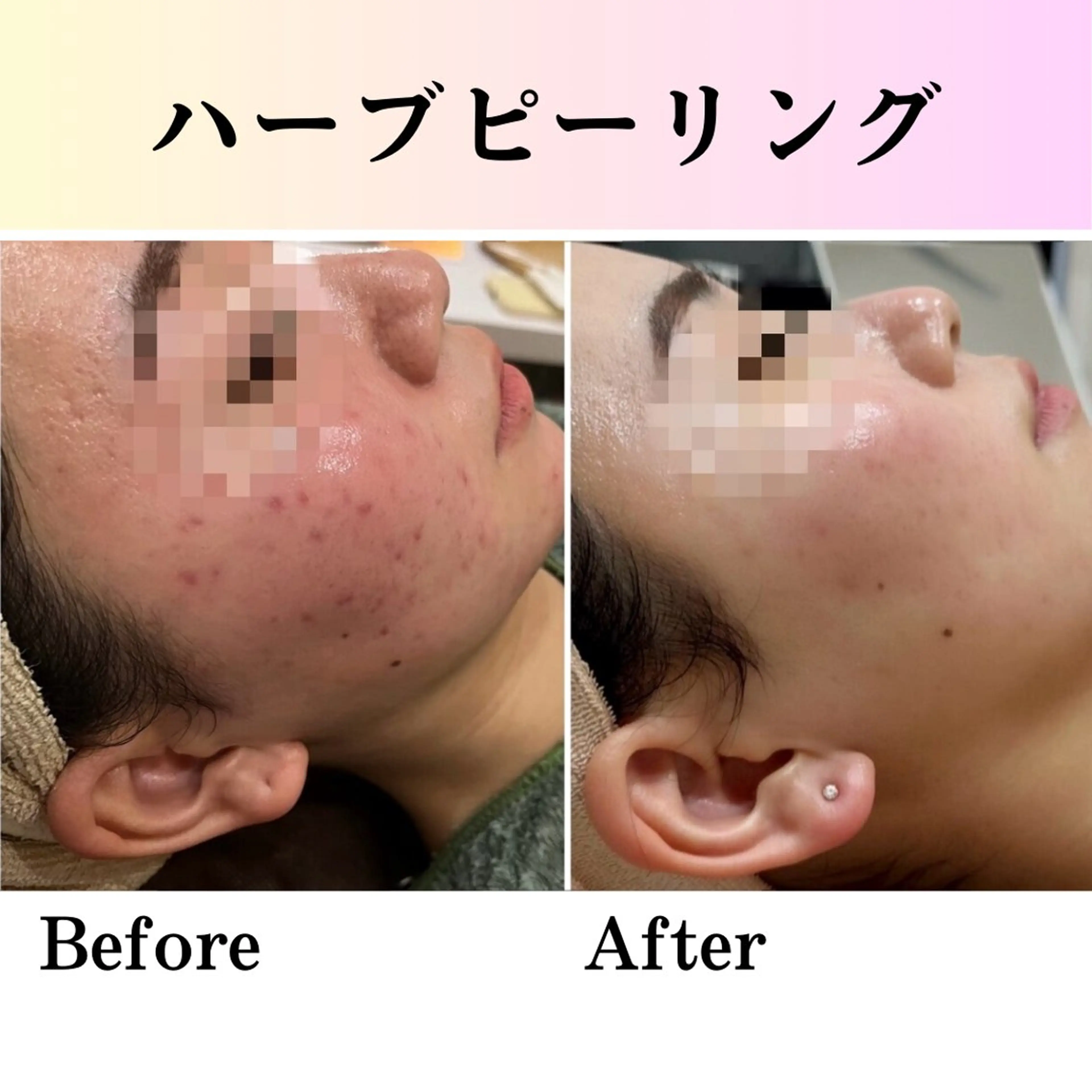 美肌脱毛サロン muroのエステ・リラクイメージ