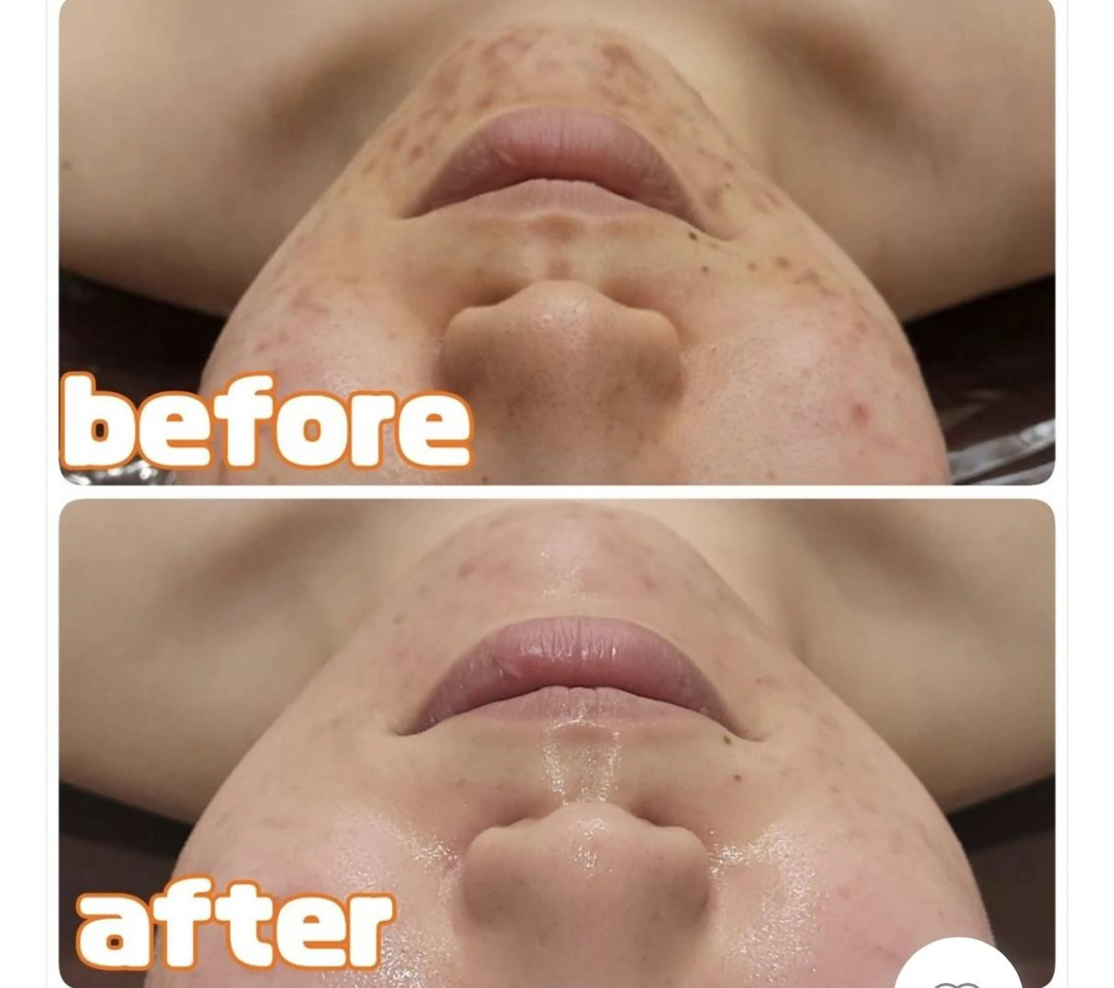 レイビス 渋谷店中野🤍のエステ・リラクイメージ