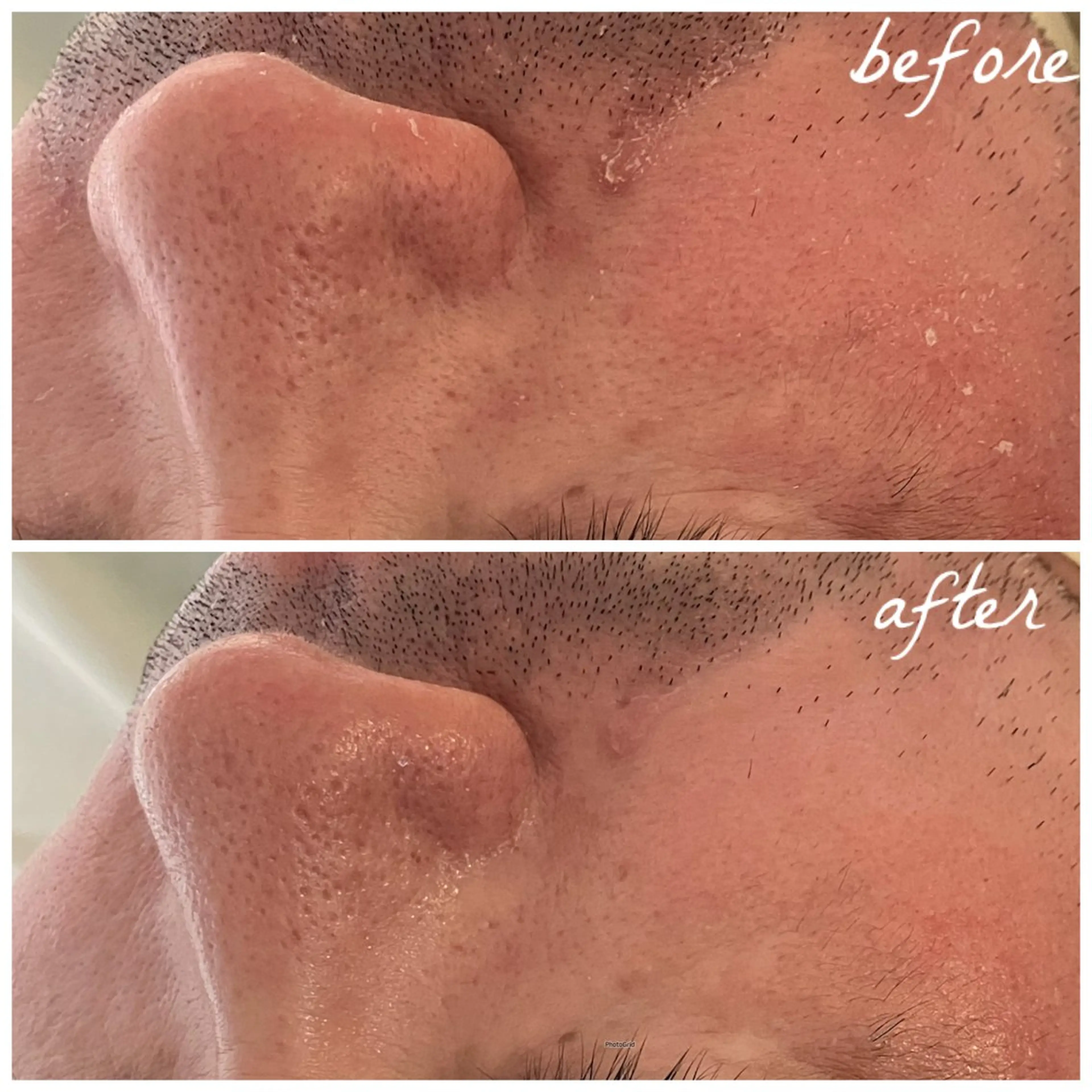 メンズ エステ メナード岐阜茜部 杉浦のエステ・リラクイメージ