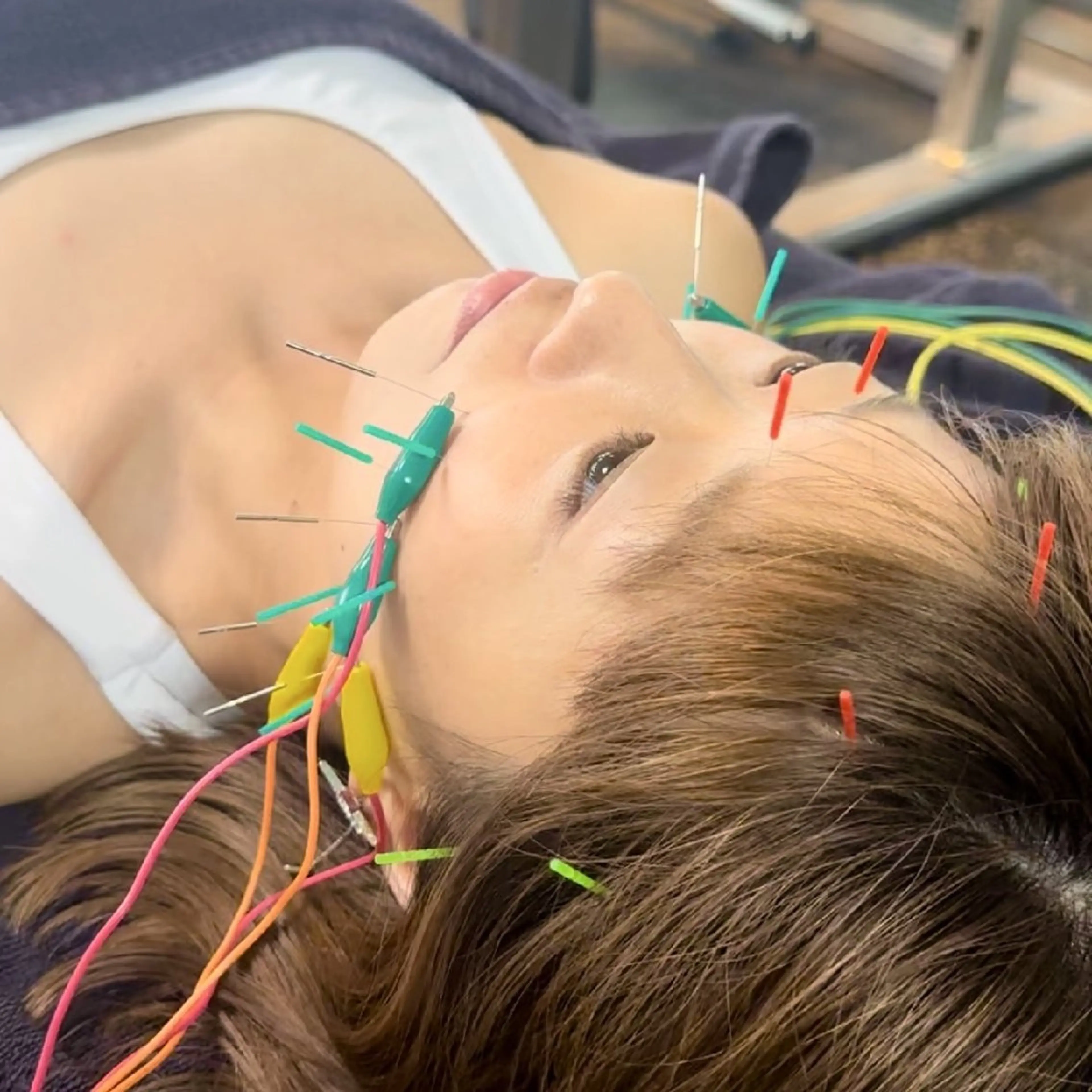 エステ リラク 小顔矯正・美容鍼 FLOW鍼灸整体院のエステ・リラクイメージ