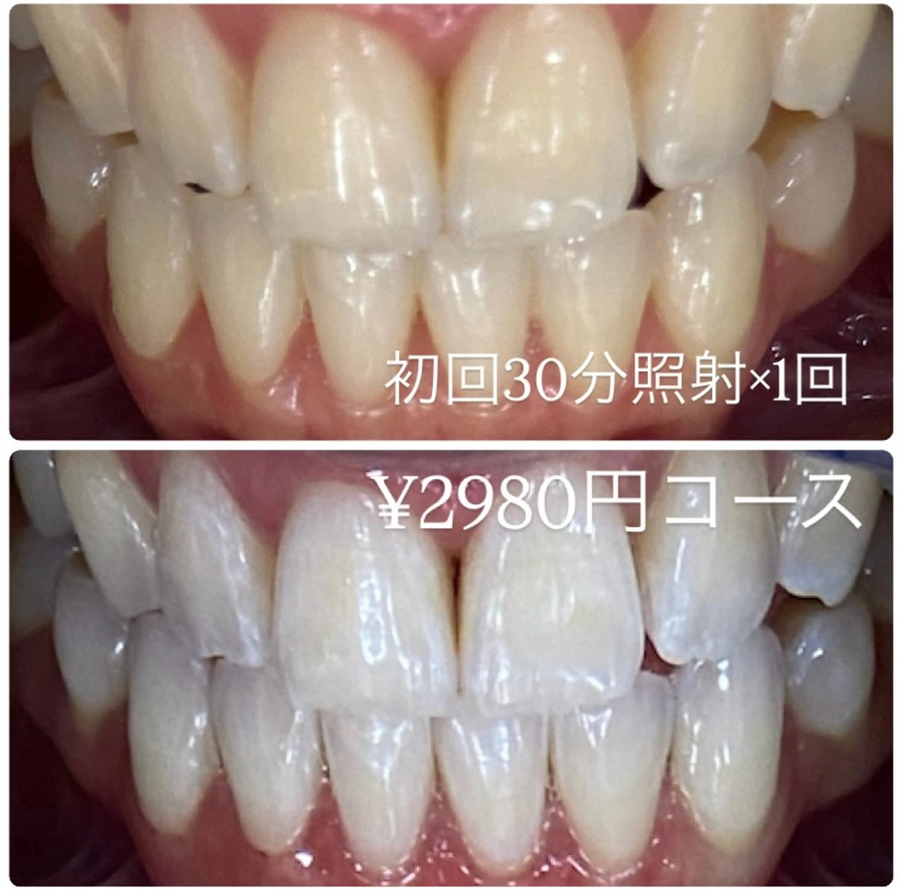 その他 PLATINUM Beauty 横浜店所属・ホワイトニングルーム 横浜店のその他イメージ