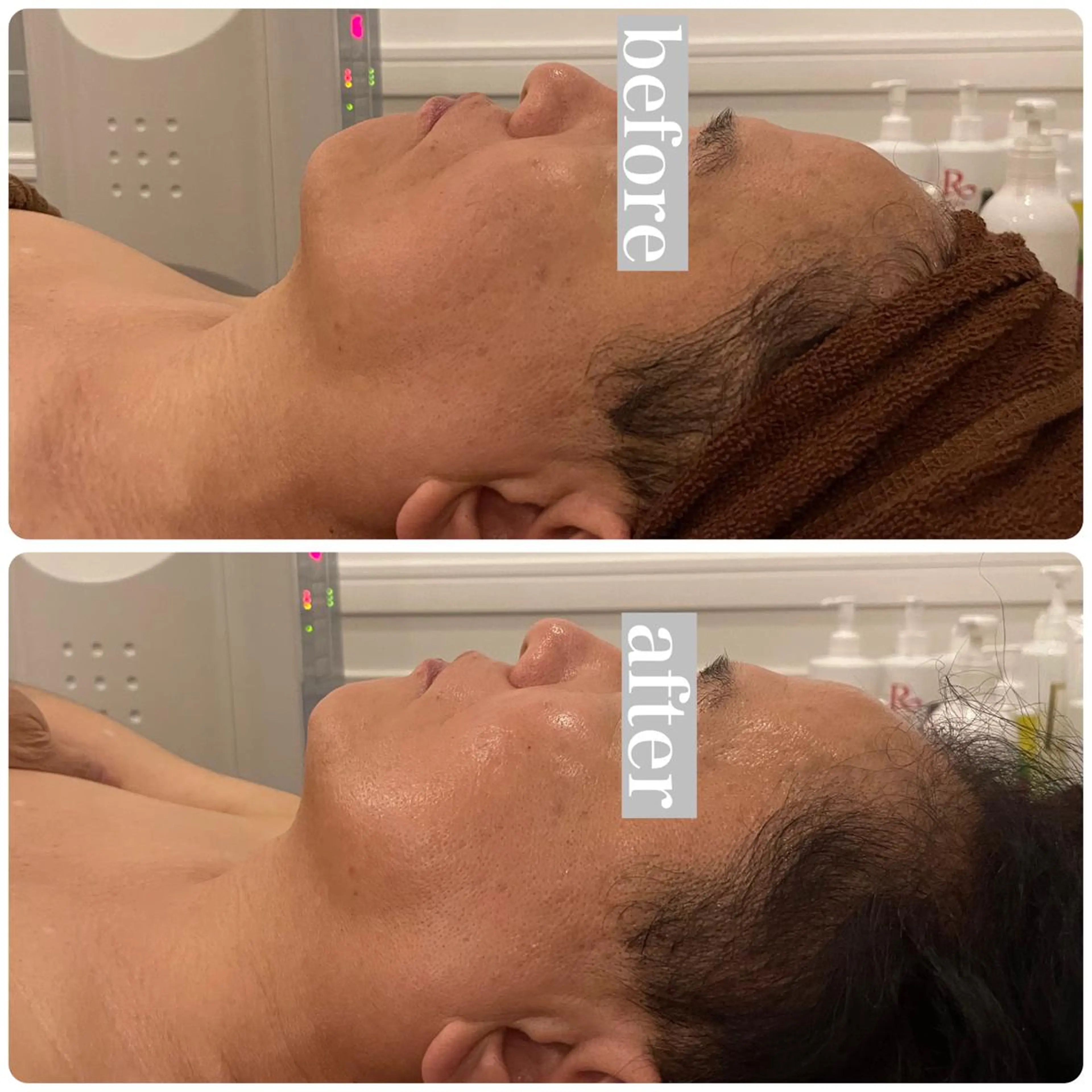 エステ リラク 立体小顔×艶肌×美ボ ディ似合わせ施術 岡のエステ・リラクイメージ