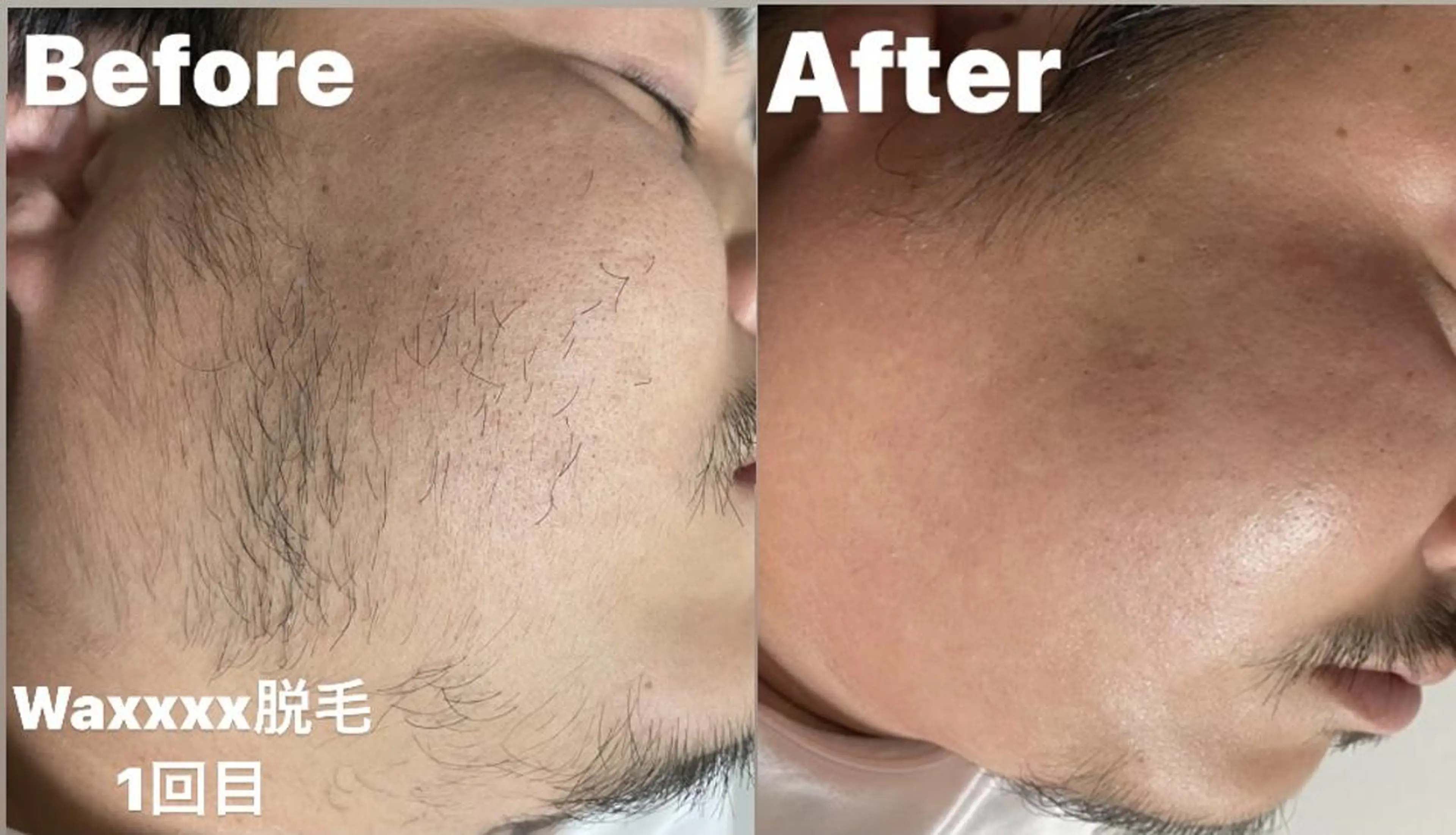 メンズ 脱毛 Epina 千葉店 【エピナ】のエステ・リラクイメージ