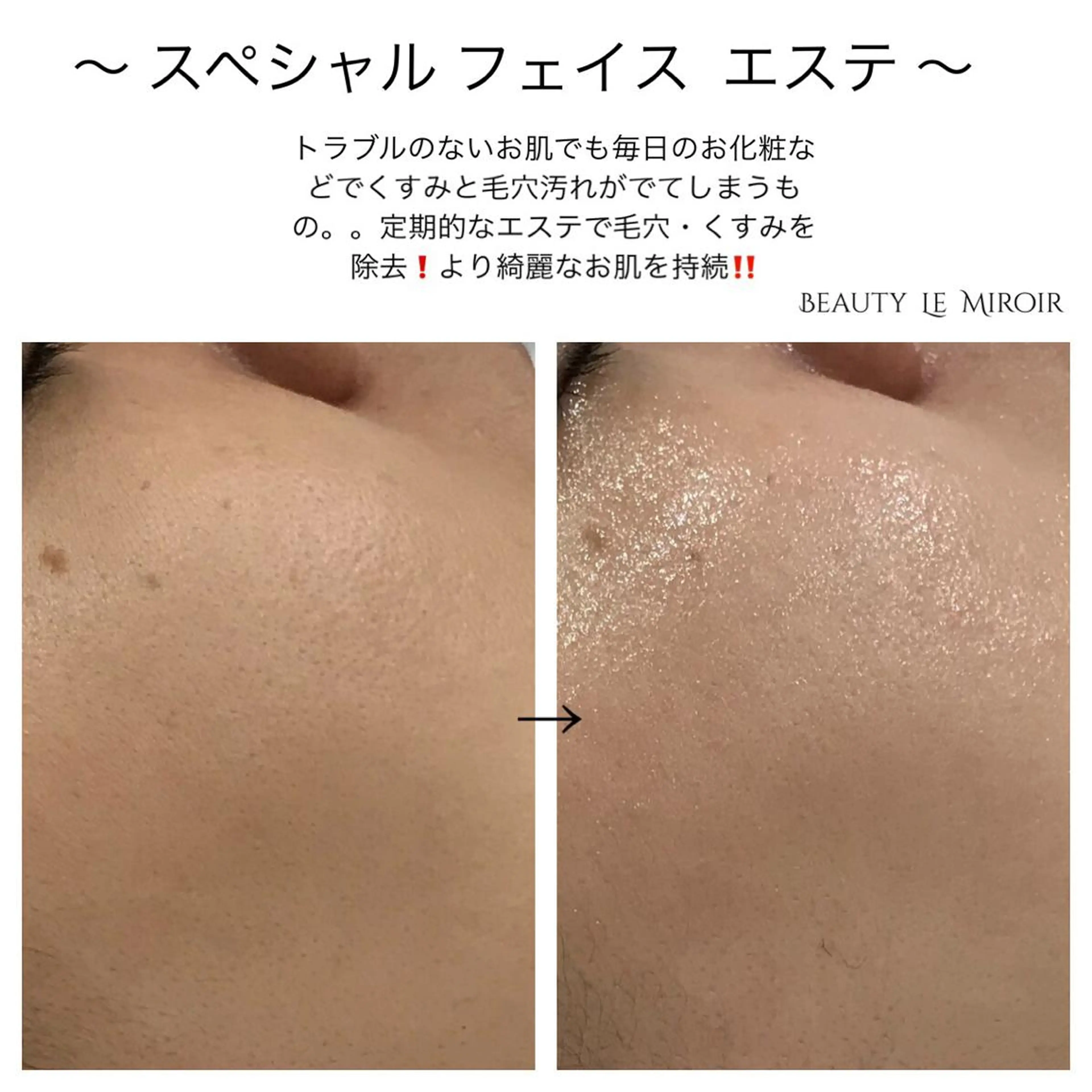 ビューティー ミロワールのエステ・リラクイメージ