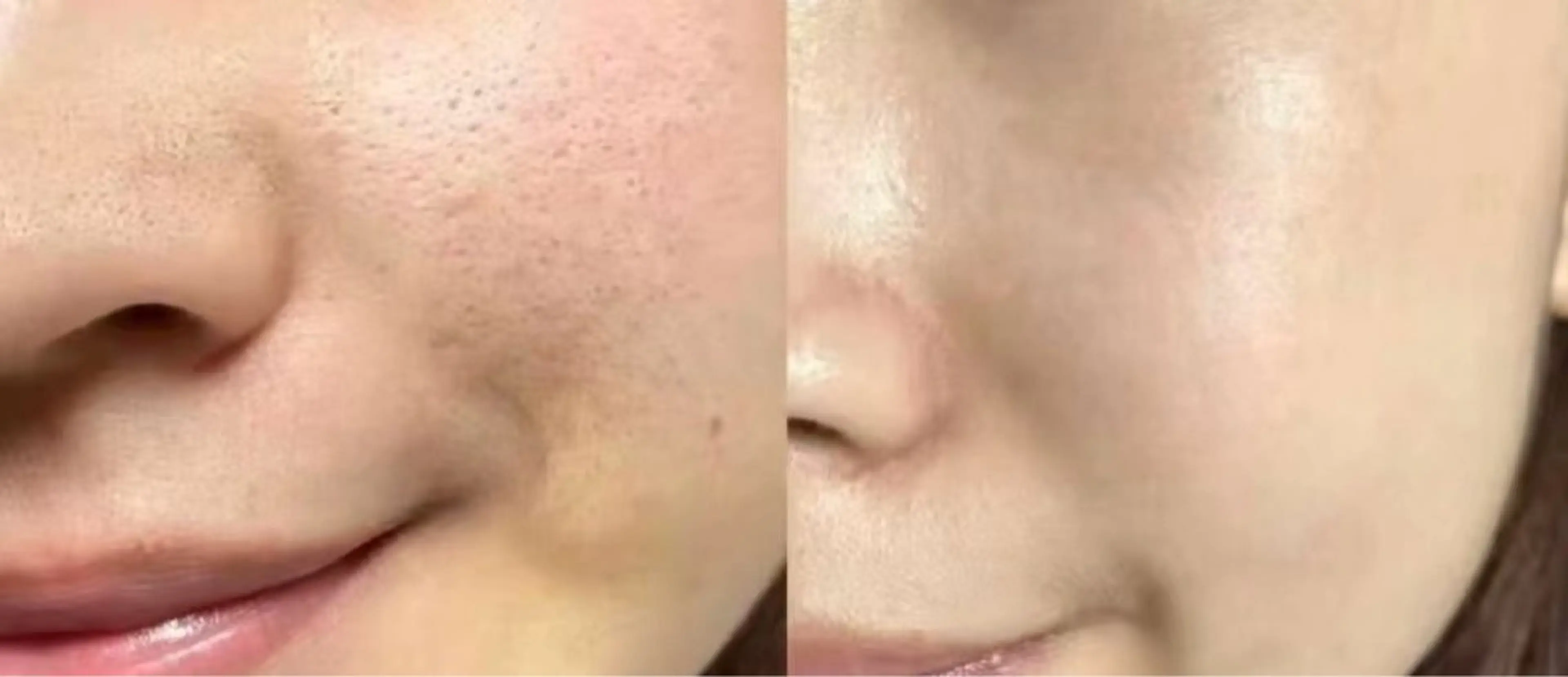 エステ エステサロン lindyのエステ・リラクイメージ