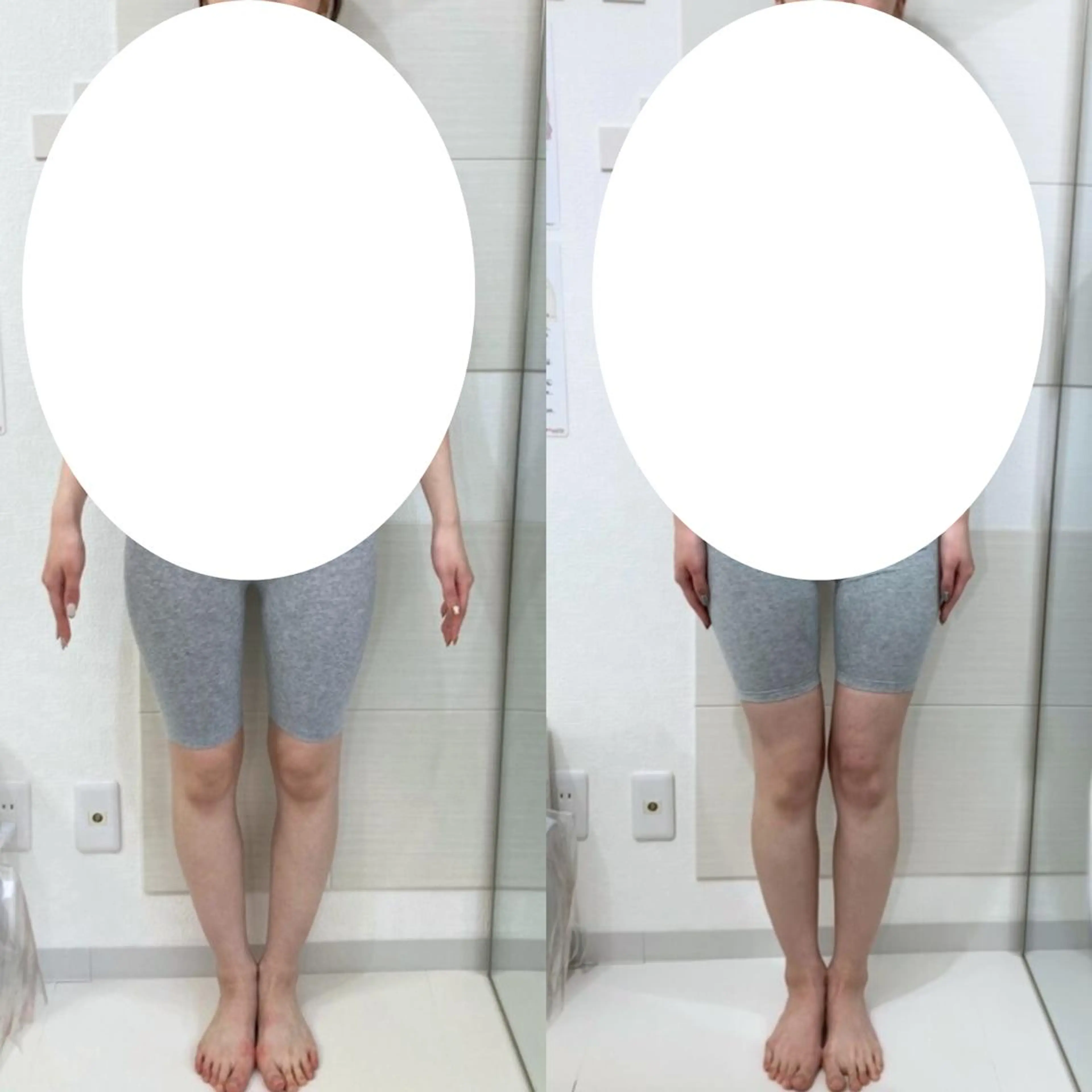 骨格美容整体 bimote.新宿のエステ・リラクイメージ