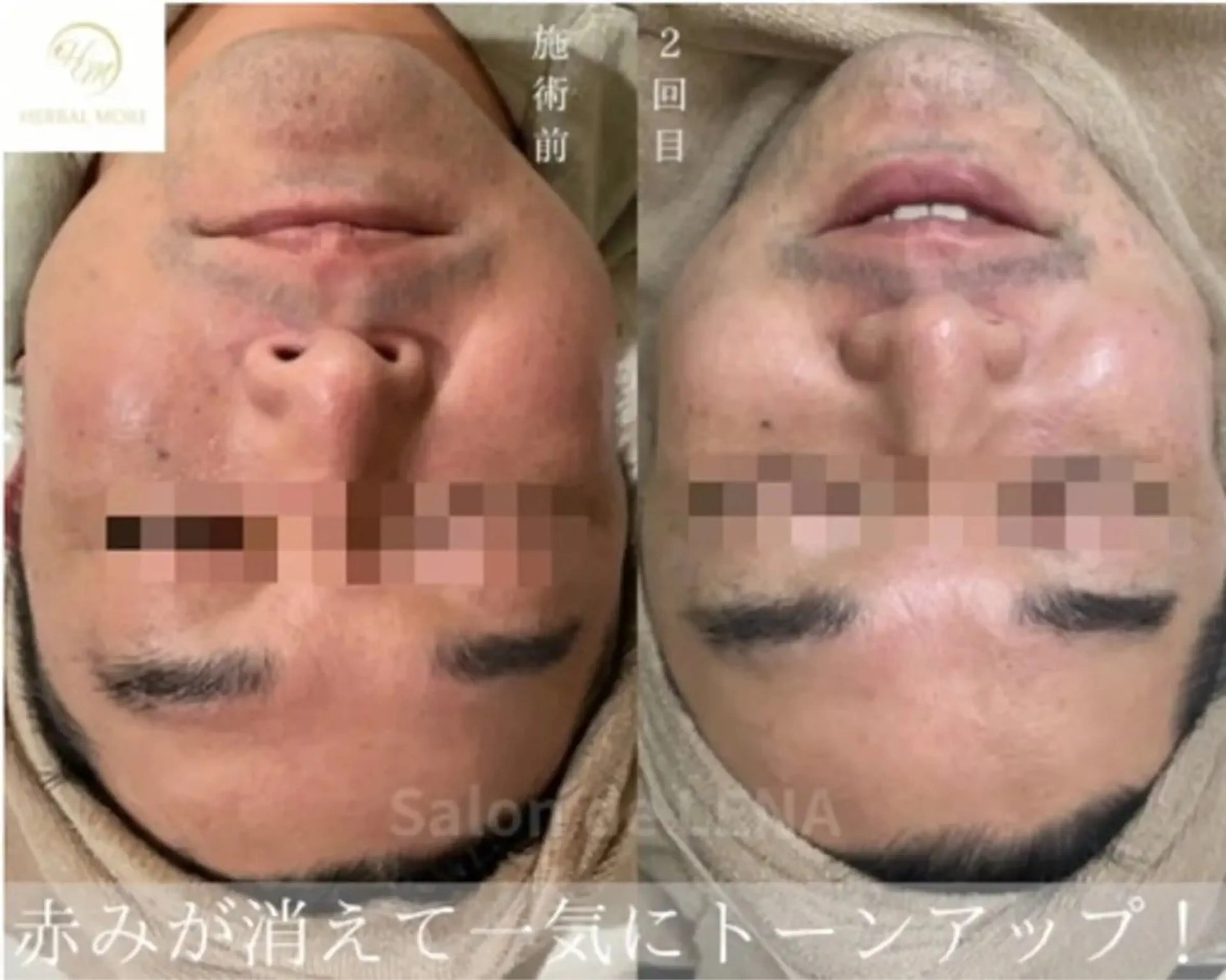 ハーブピーリング専門 グランディール　武内のエステ・リラクイメージ