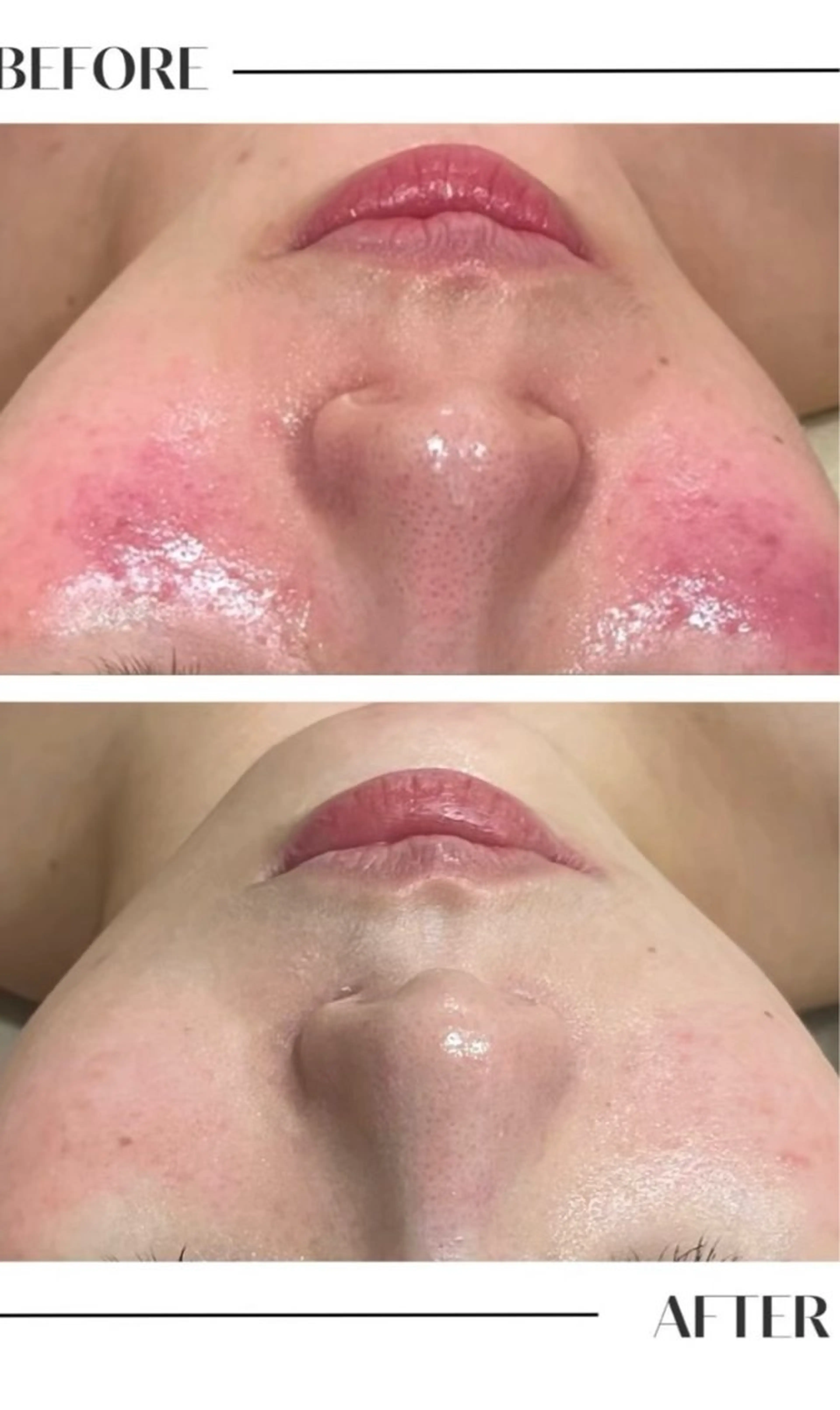 エステ フェイシャル/脱毛 ジョアアンジェ小夷のエステ・リラクイメージ