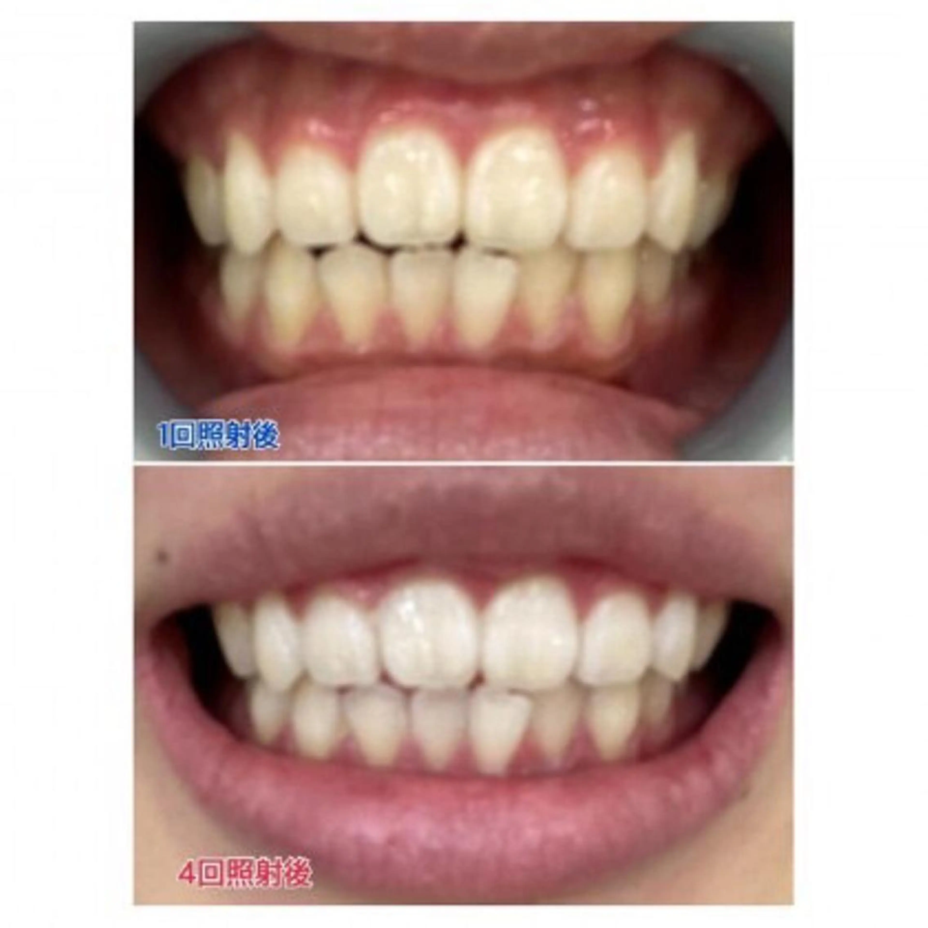 Ｍ渋谷 ホワイトニングのエステ・リラクイメージ