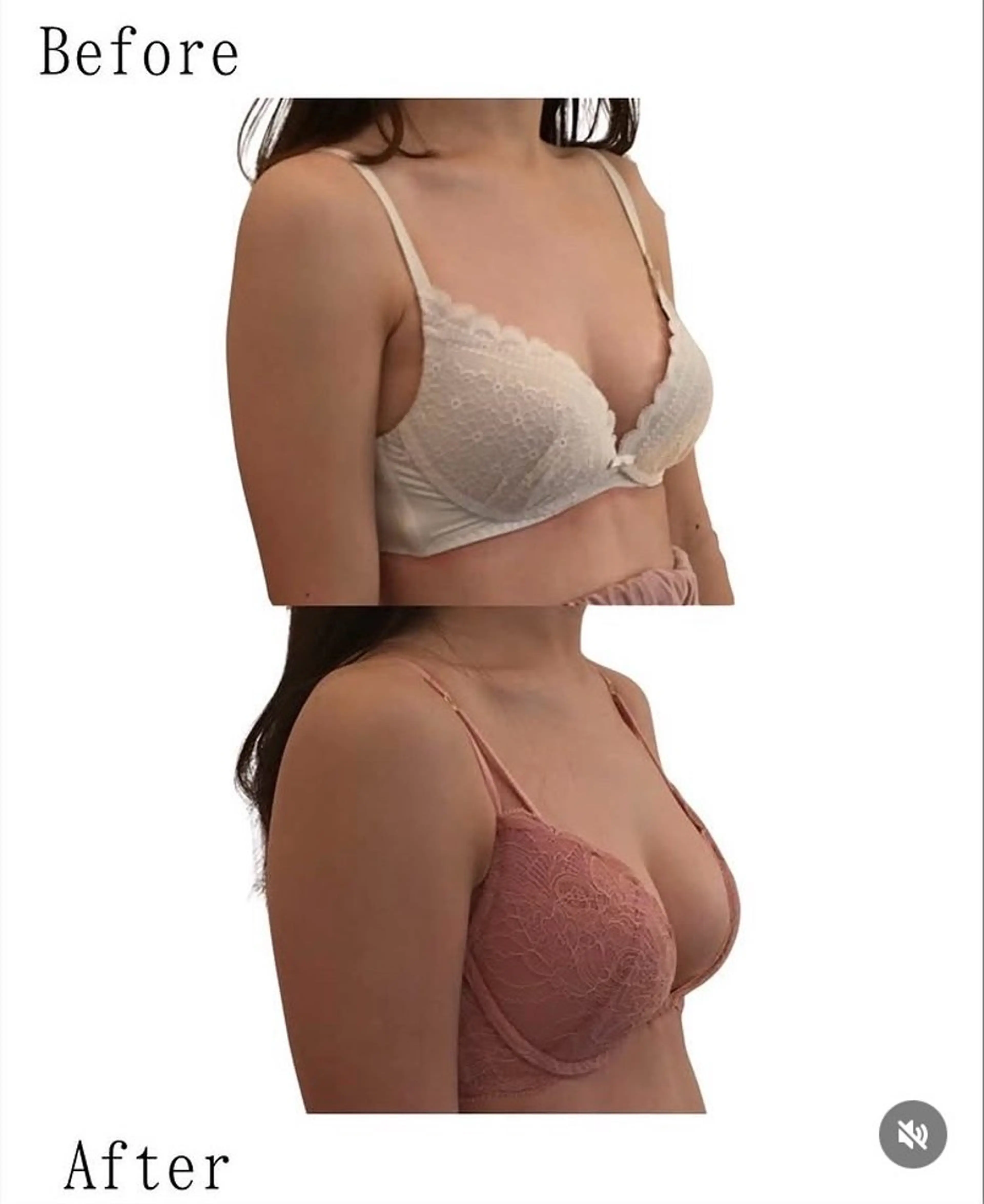 ショート エステ バストアップ・艶肌専門店Venus所属・高橋 優子のエステ・リラクイメージ