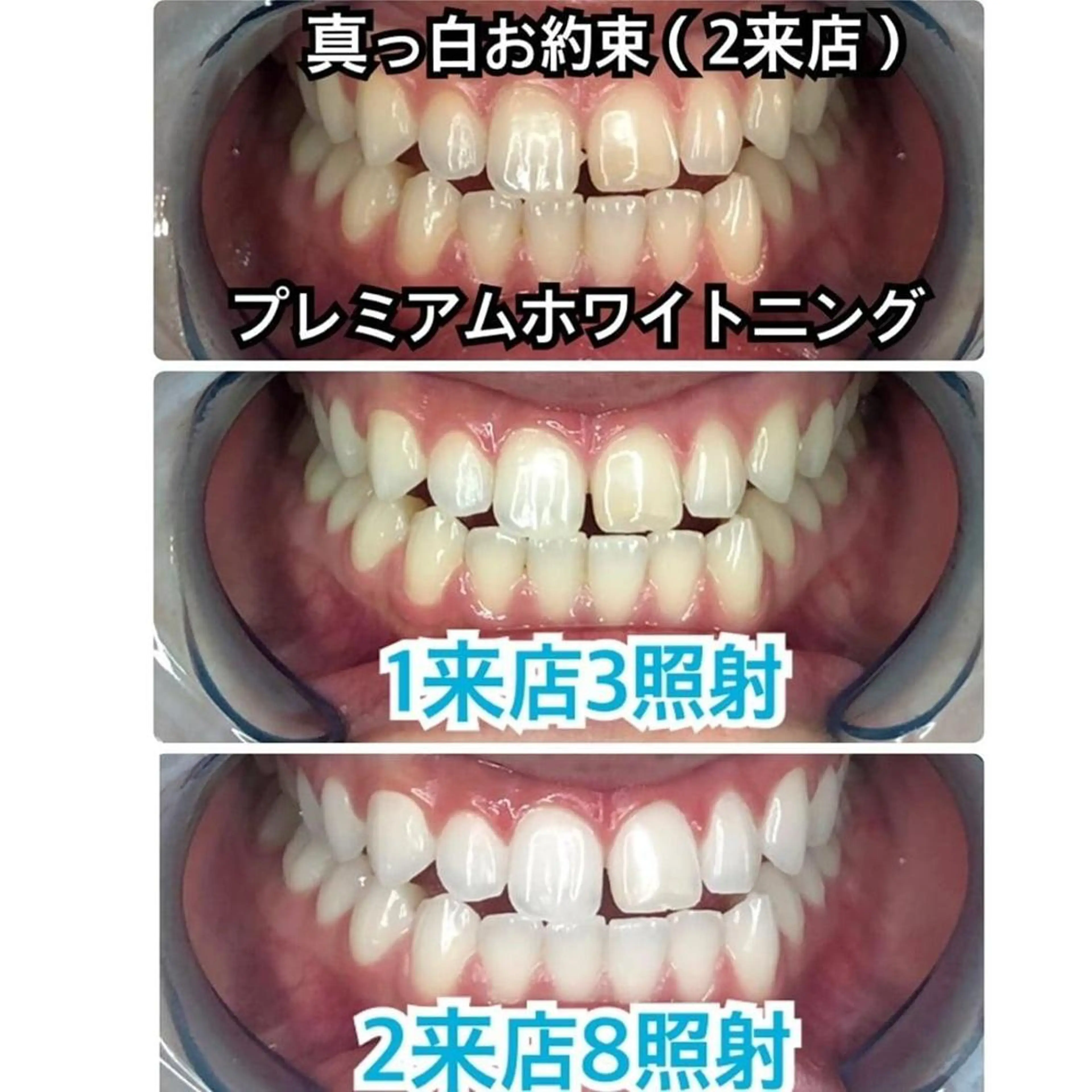 ホワイトニングビューティー西宮店所属・ホワイトニングビュー ティー西宮店のその他イメージ