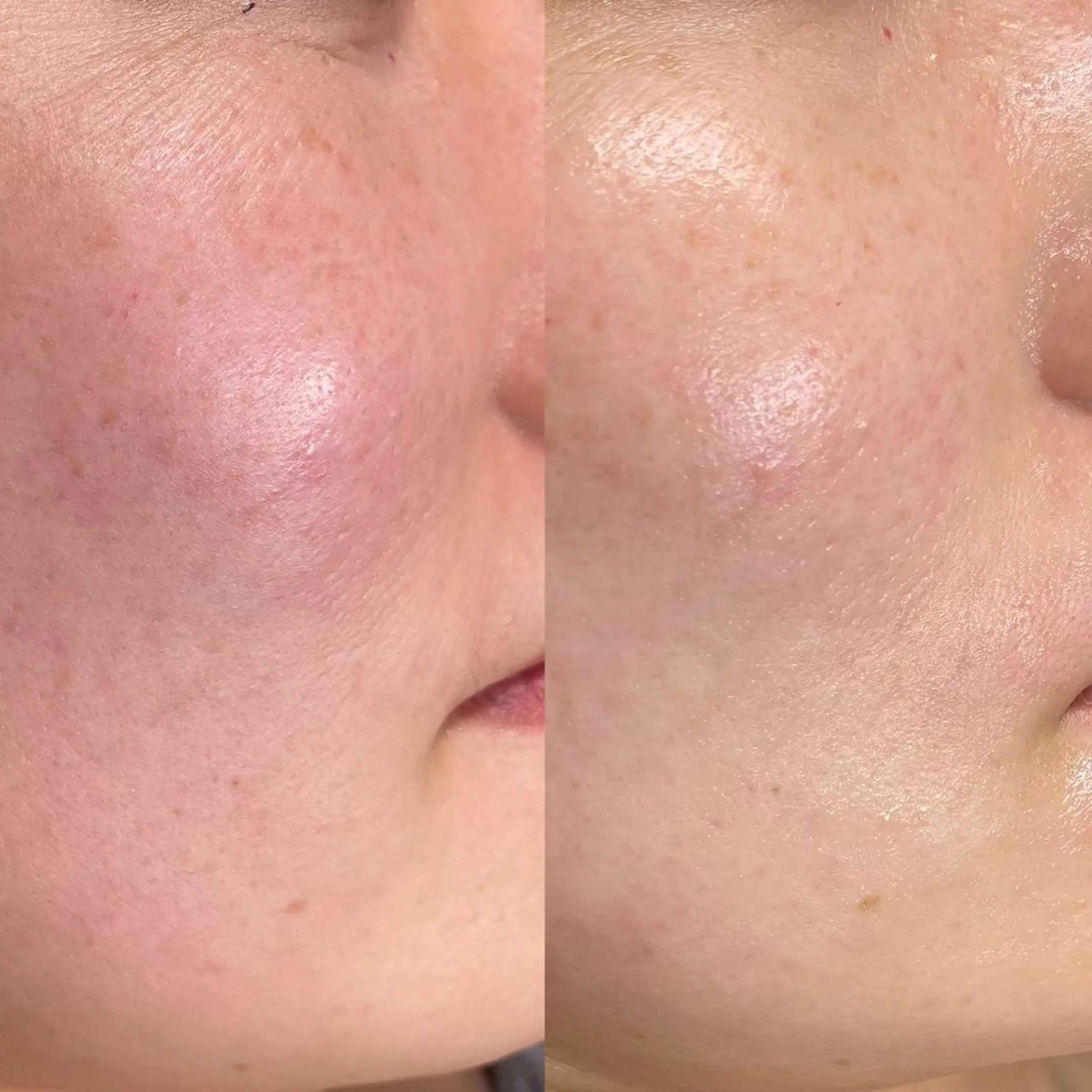 emma MINORIのエステ・リラクイメージ