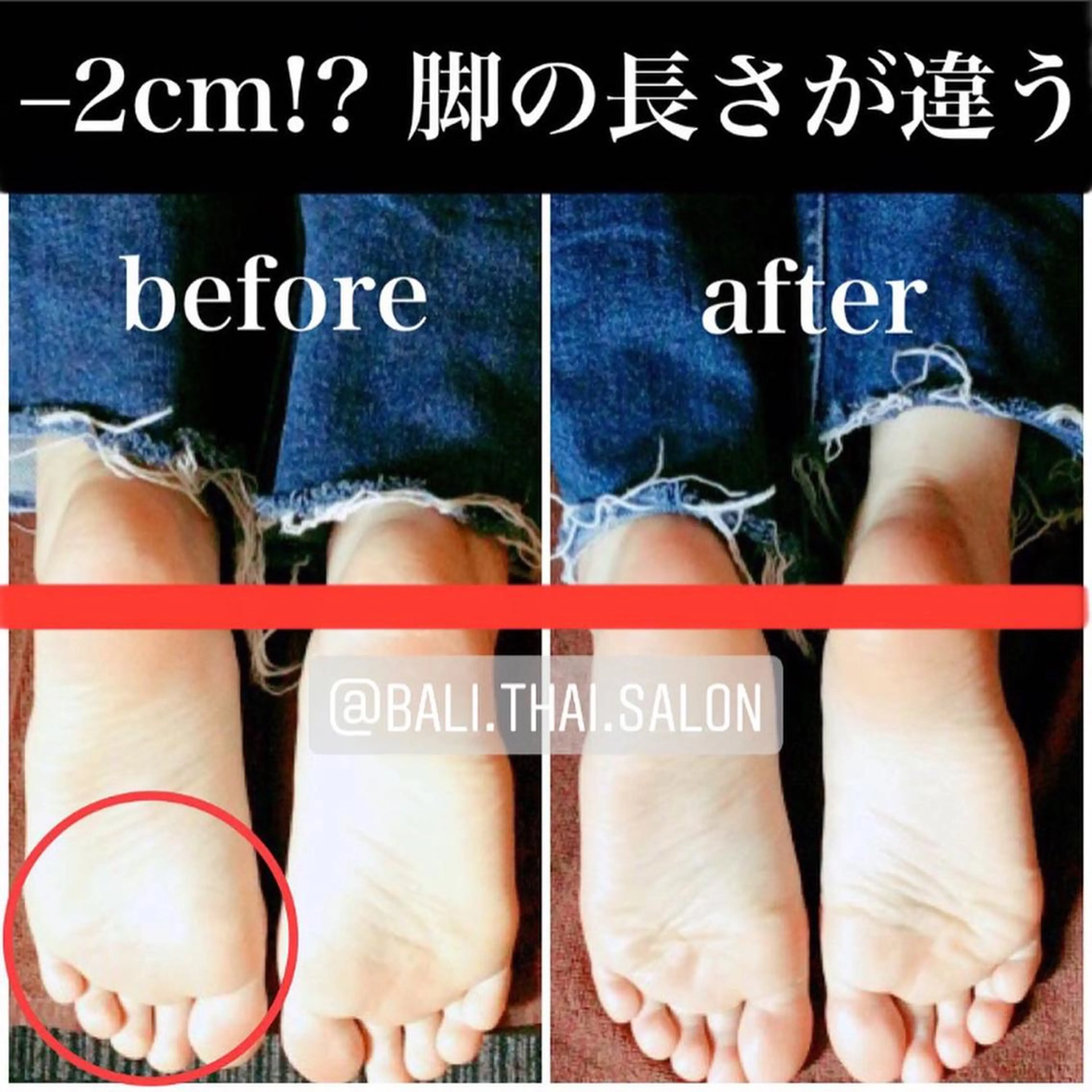 🌈歪み改善🌈 バリンタイ すぎうらのエステ・リラクイメージ