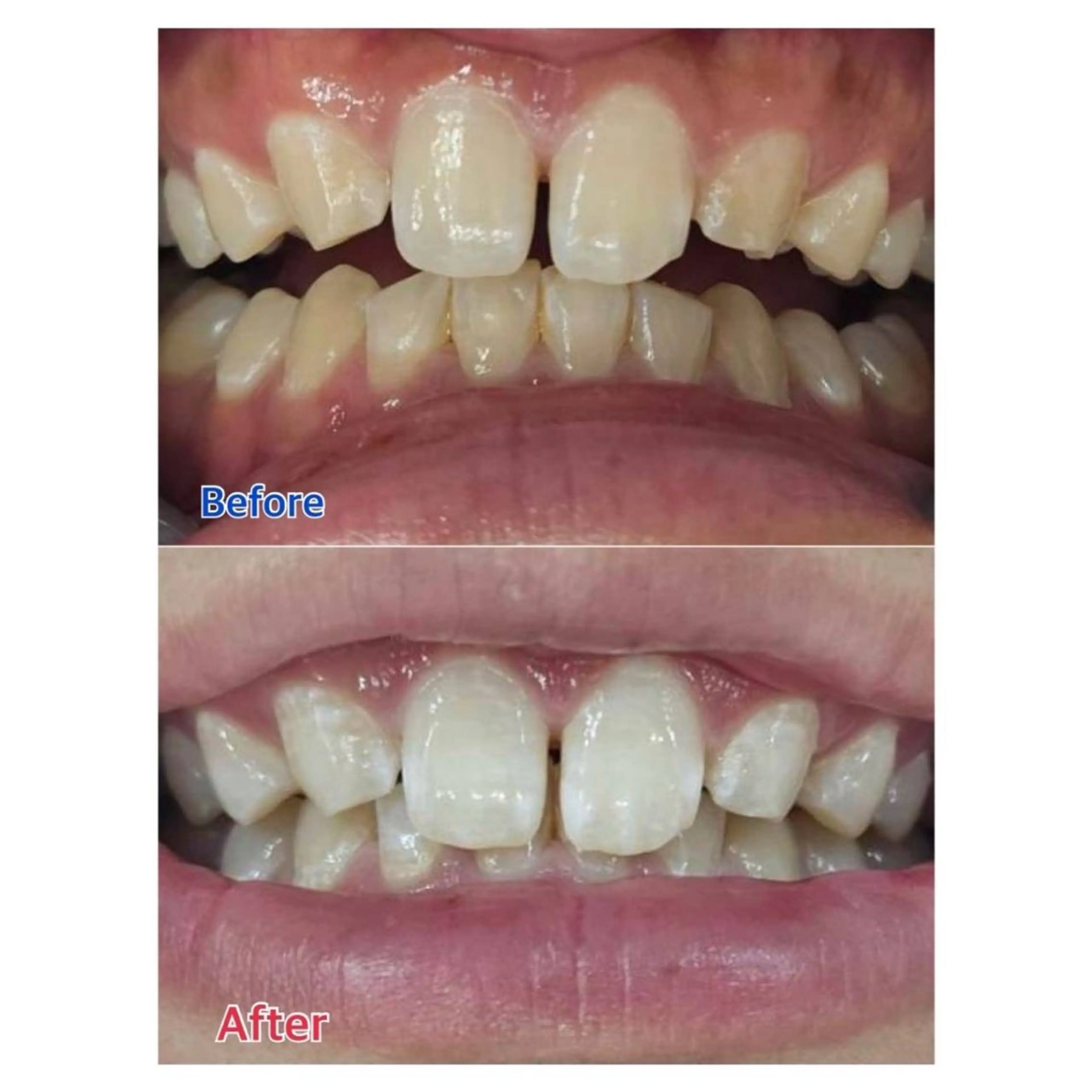 Melty 輝のその他イメージ