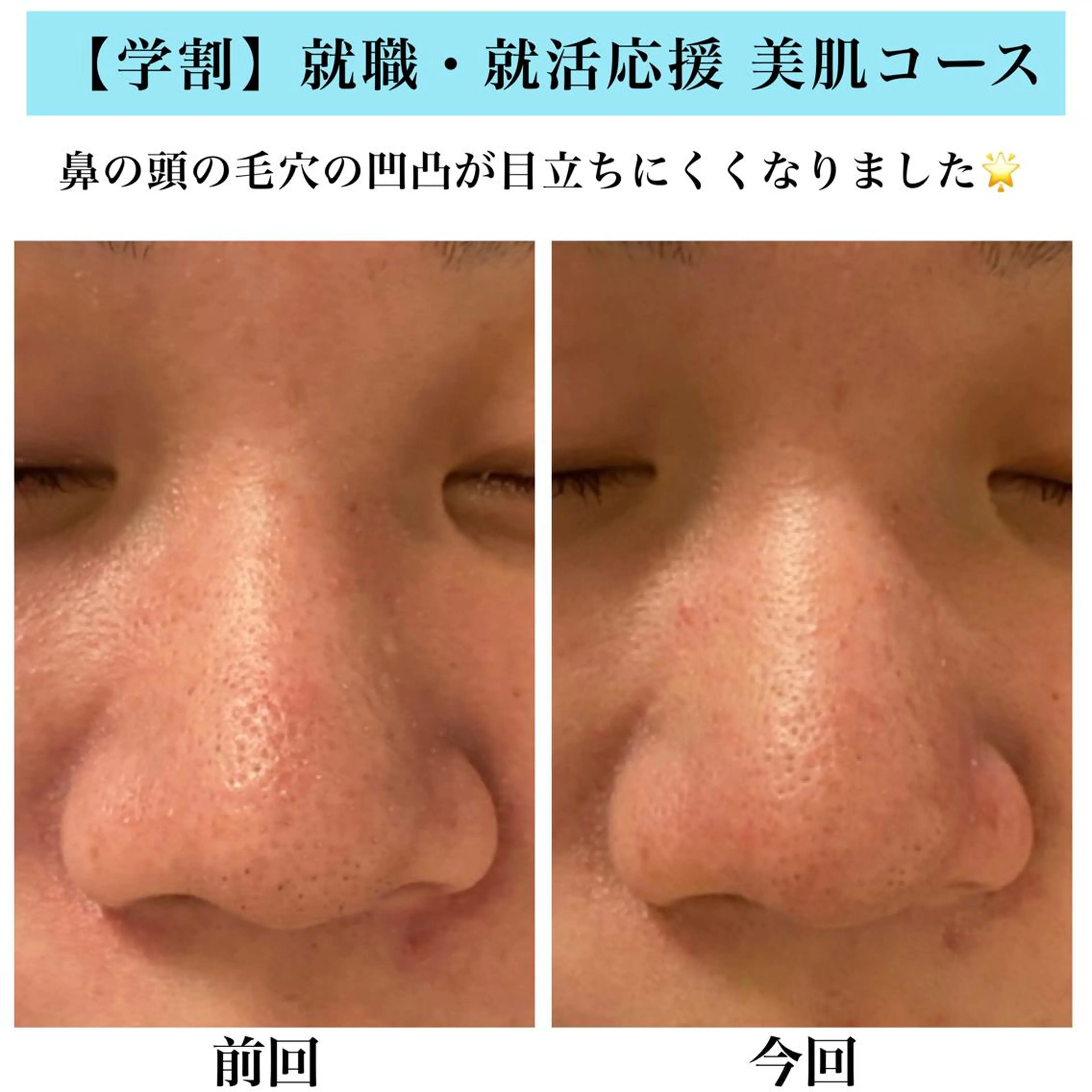 エステ Bellesthe （ベルエステ）のエステ・リラクイメージ