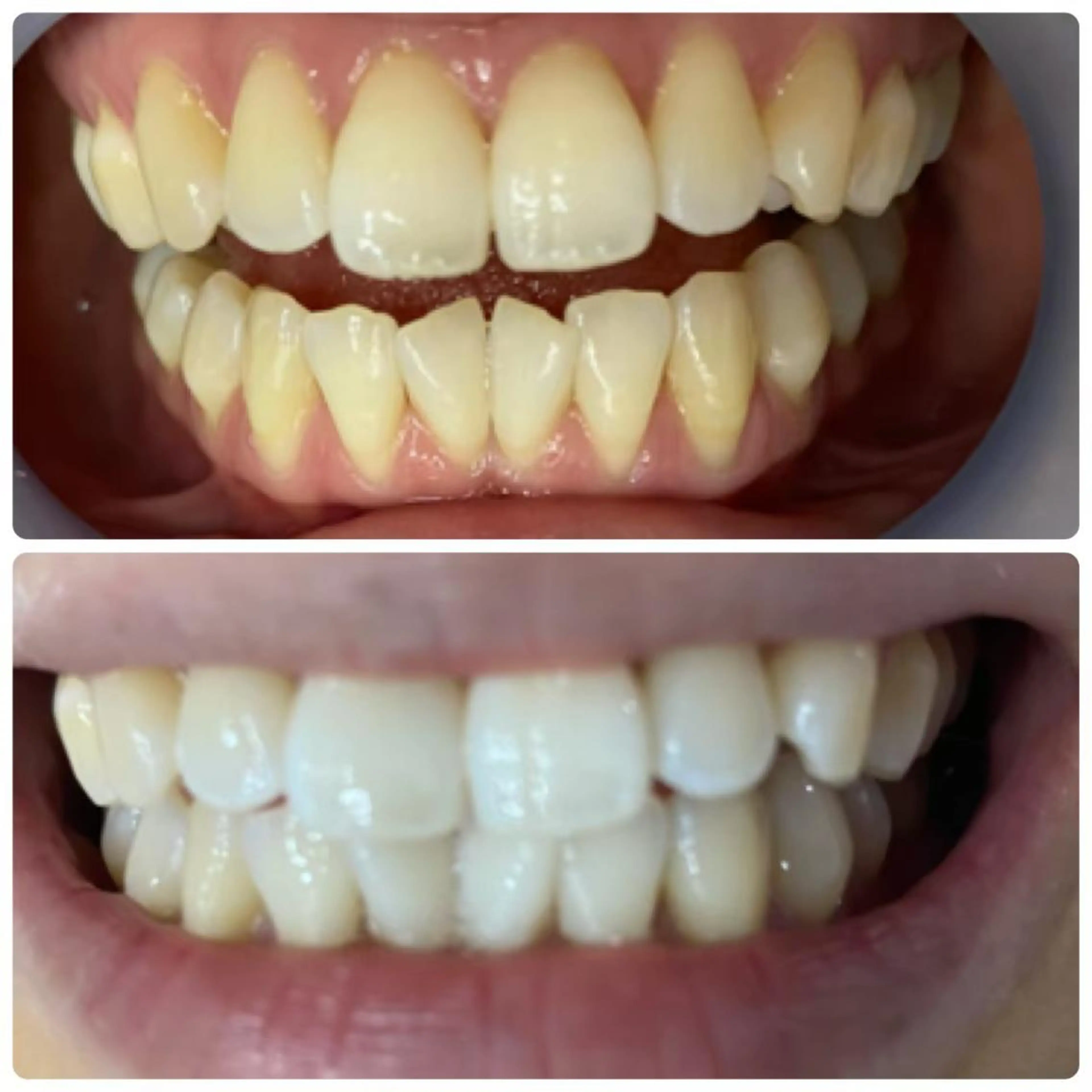 メンズ LOVEホワイト ニング恵比寿店のその他イメージ