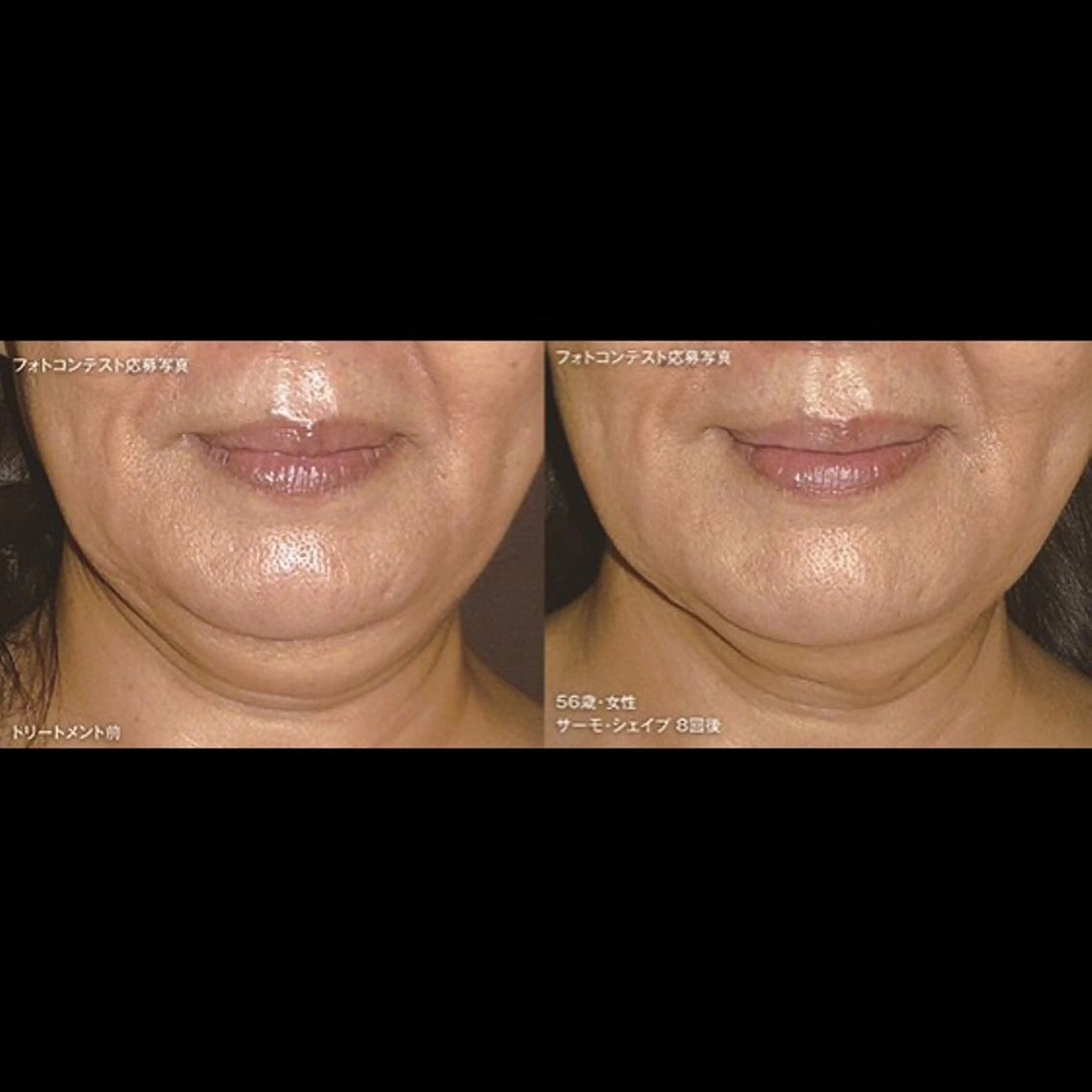 くびれ作り専門サロン こねこのシッポ虎ノ門のエステ・リラクイメージ