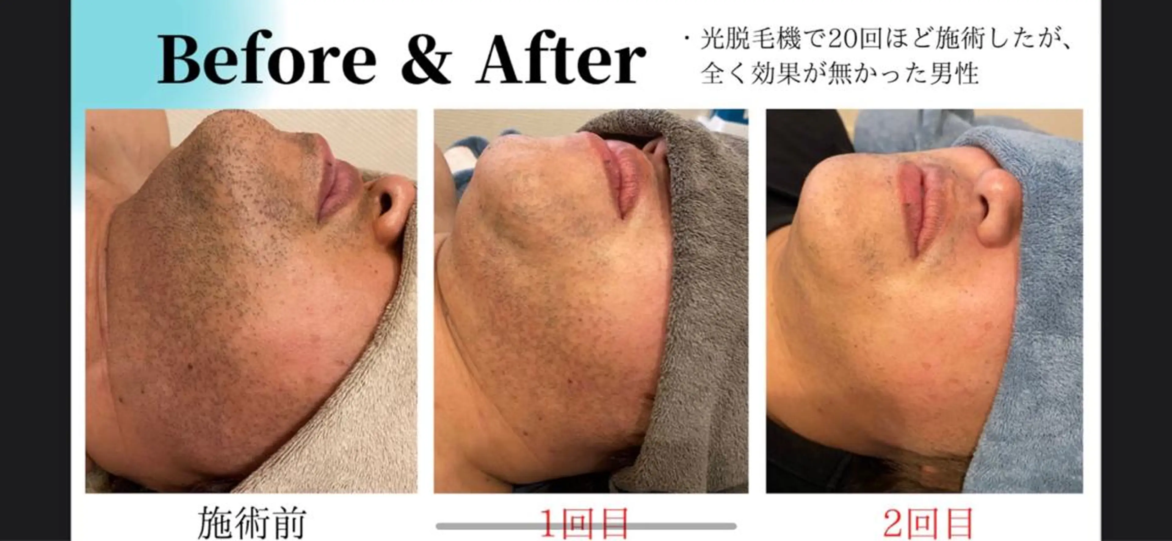 CHERIMO シェリモのネイルデザイン