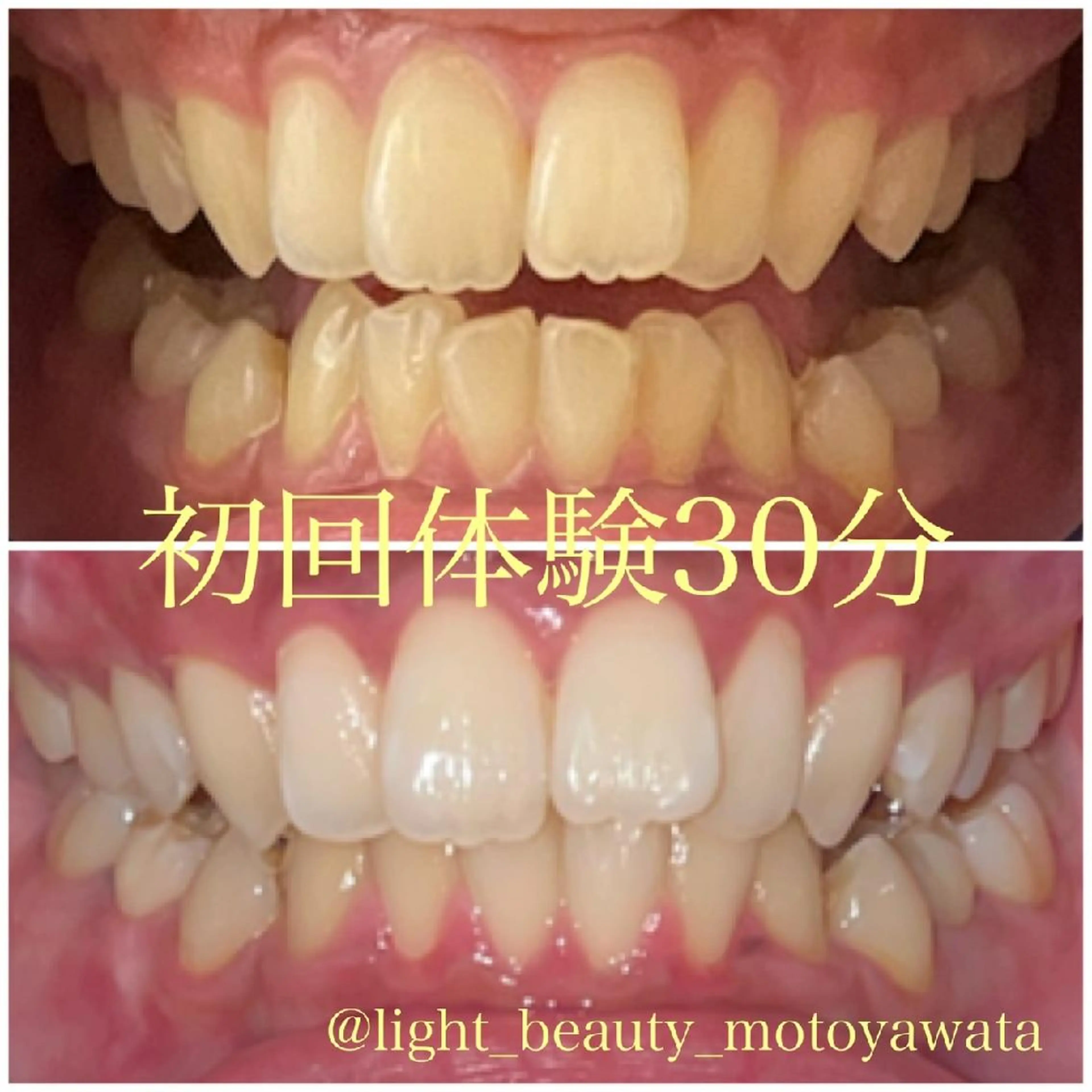 その他 五十嵐 蓮のその他イメージ