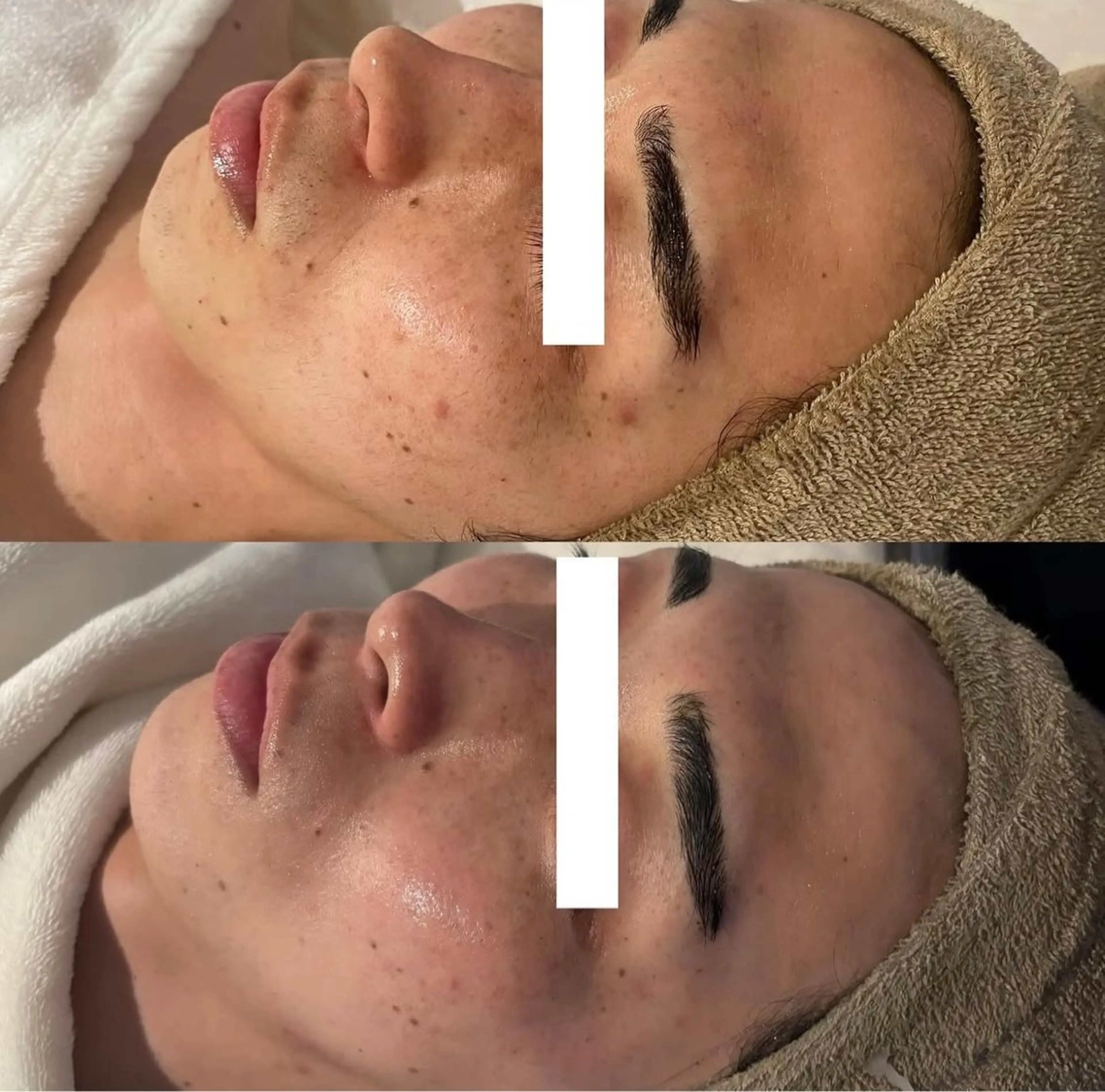 中目黒ハーブピーリン グ🌿ララピールのエステ・リラクイメージ