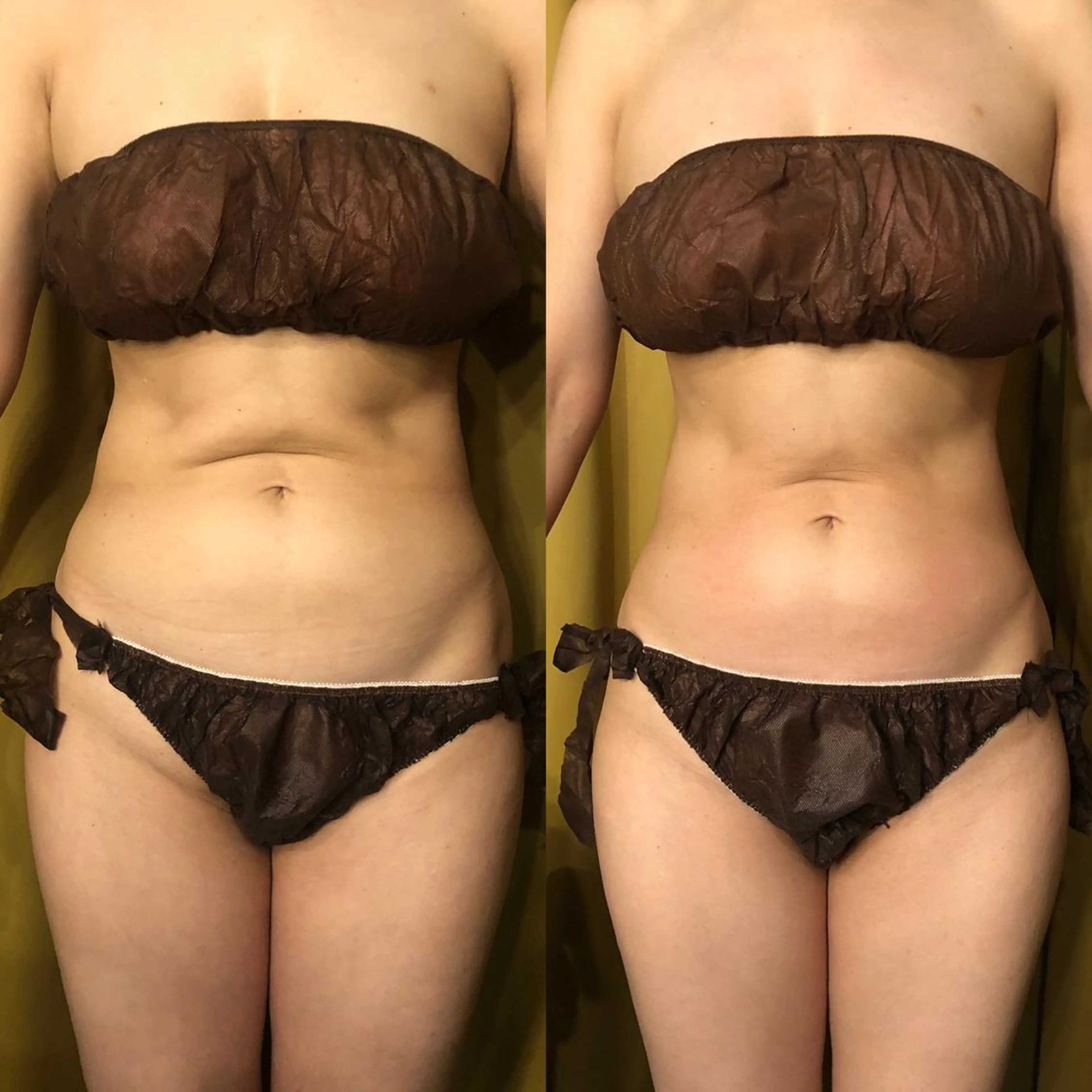 小顔＆痩身✨長谷川 ノリコのエステ・リラクイメージ