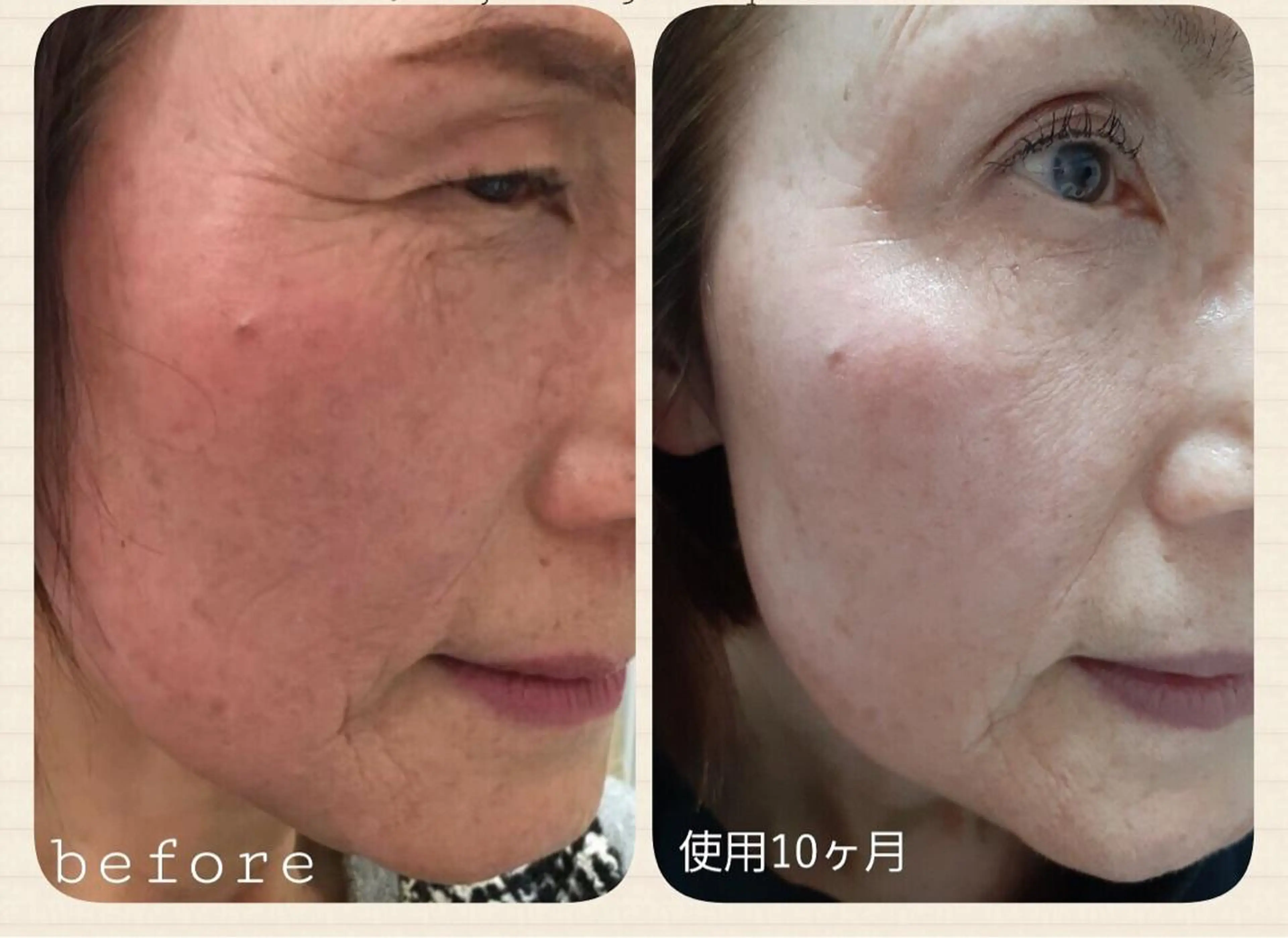 ruby cell hue.のその他イメージ