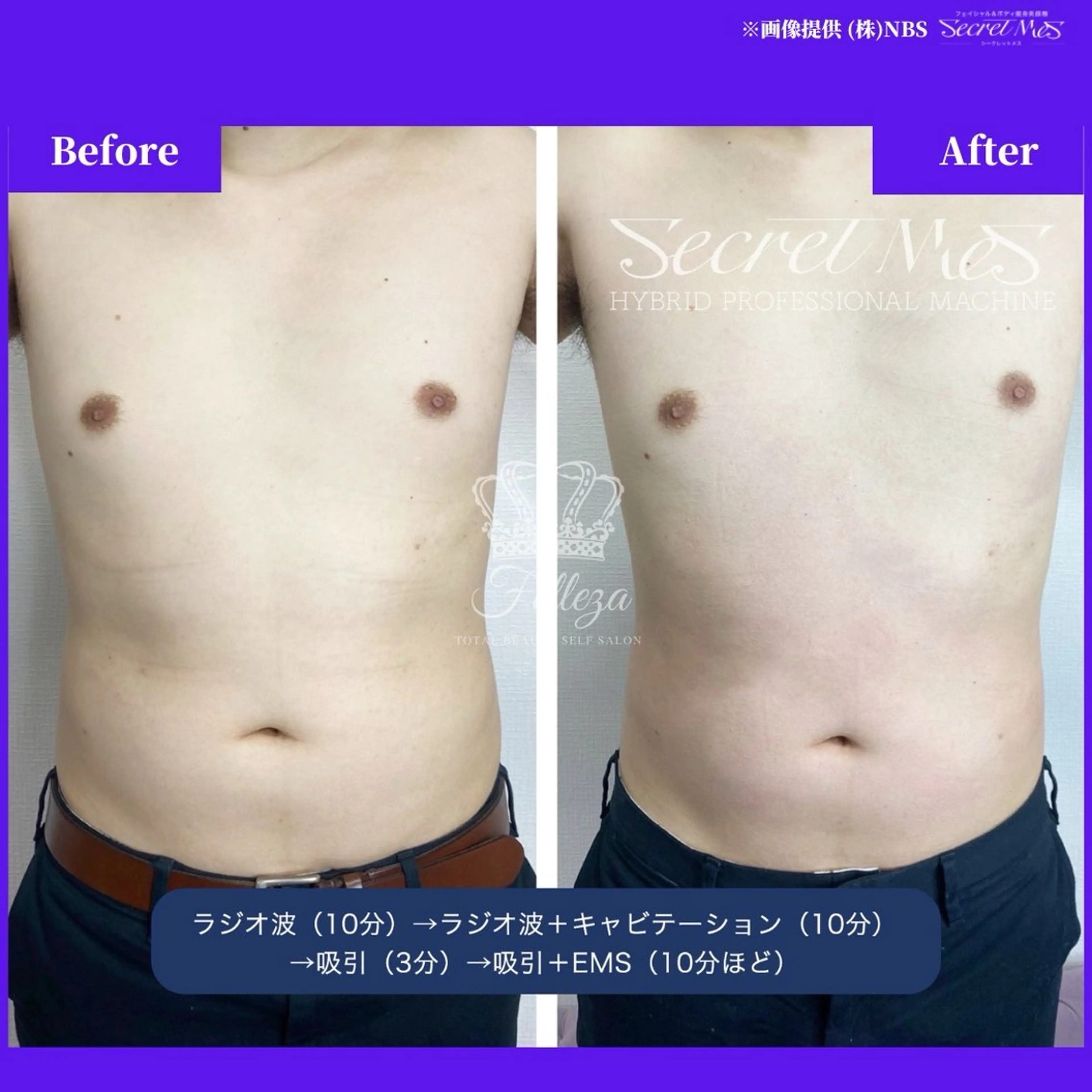 メンズ 有人型セルフサロン 脱毛／痩身／美顔のエステ・リラクイメージ