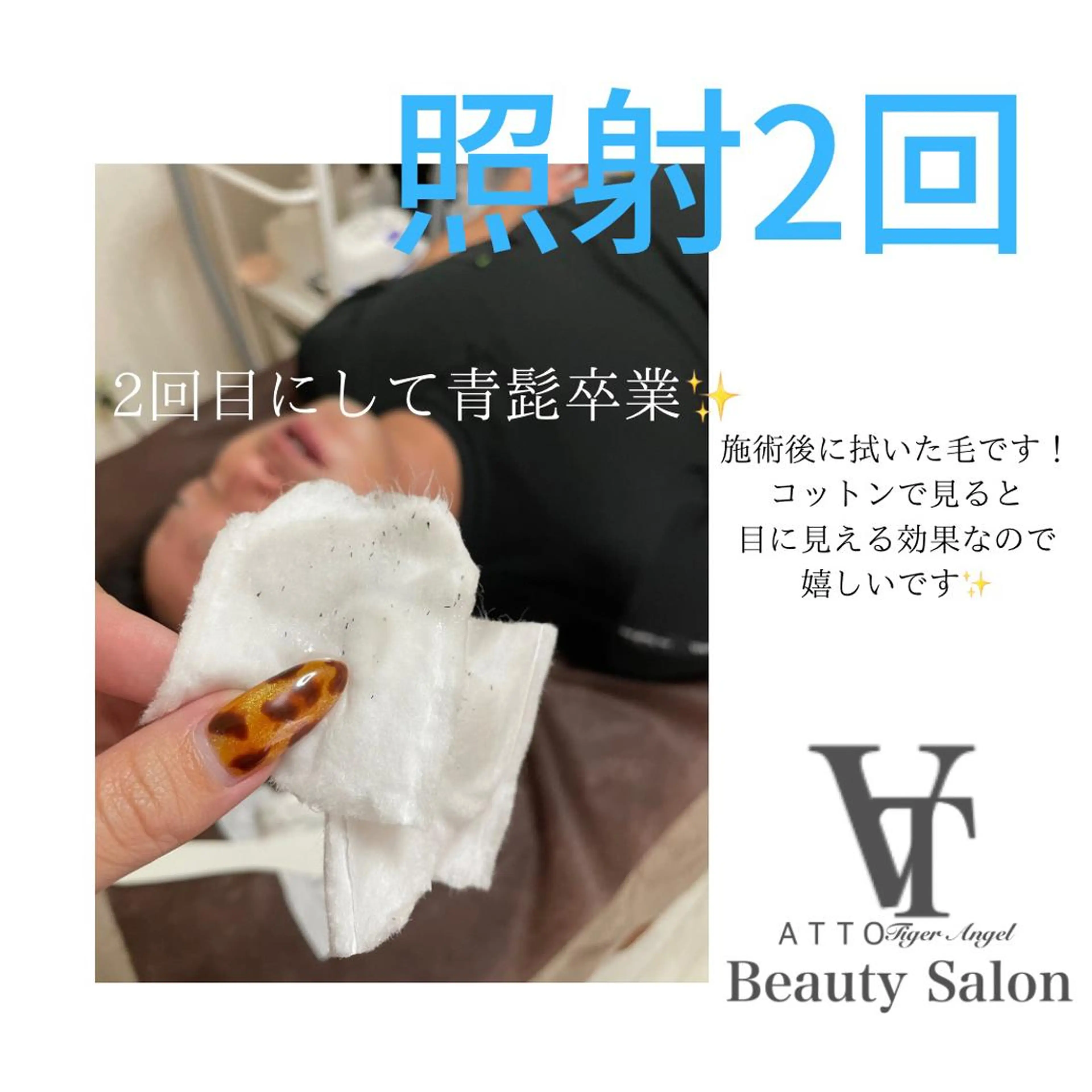 脱毛 ATTO SHIORIのエステ・リラクイメージ