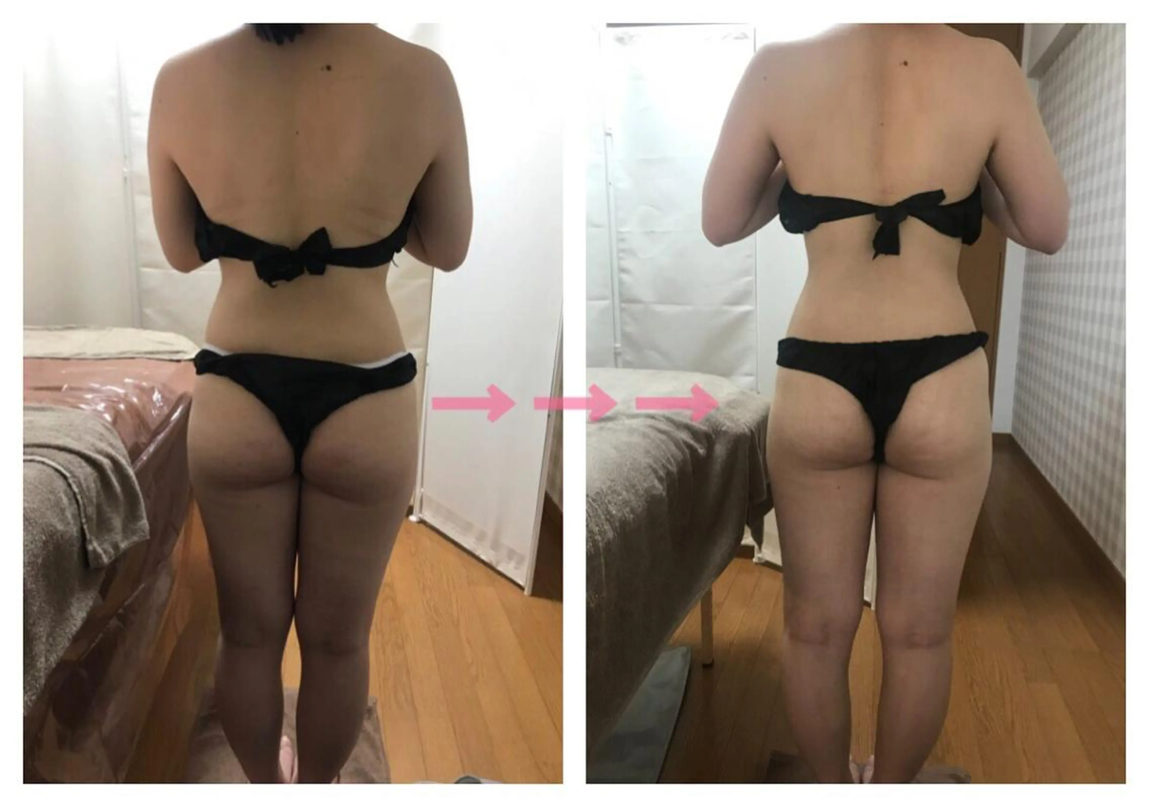 《本気痩せ×疲労改善 》  BILOOPのエステ・リラクイメージ