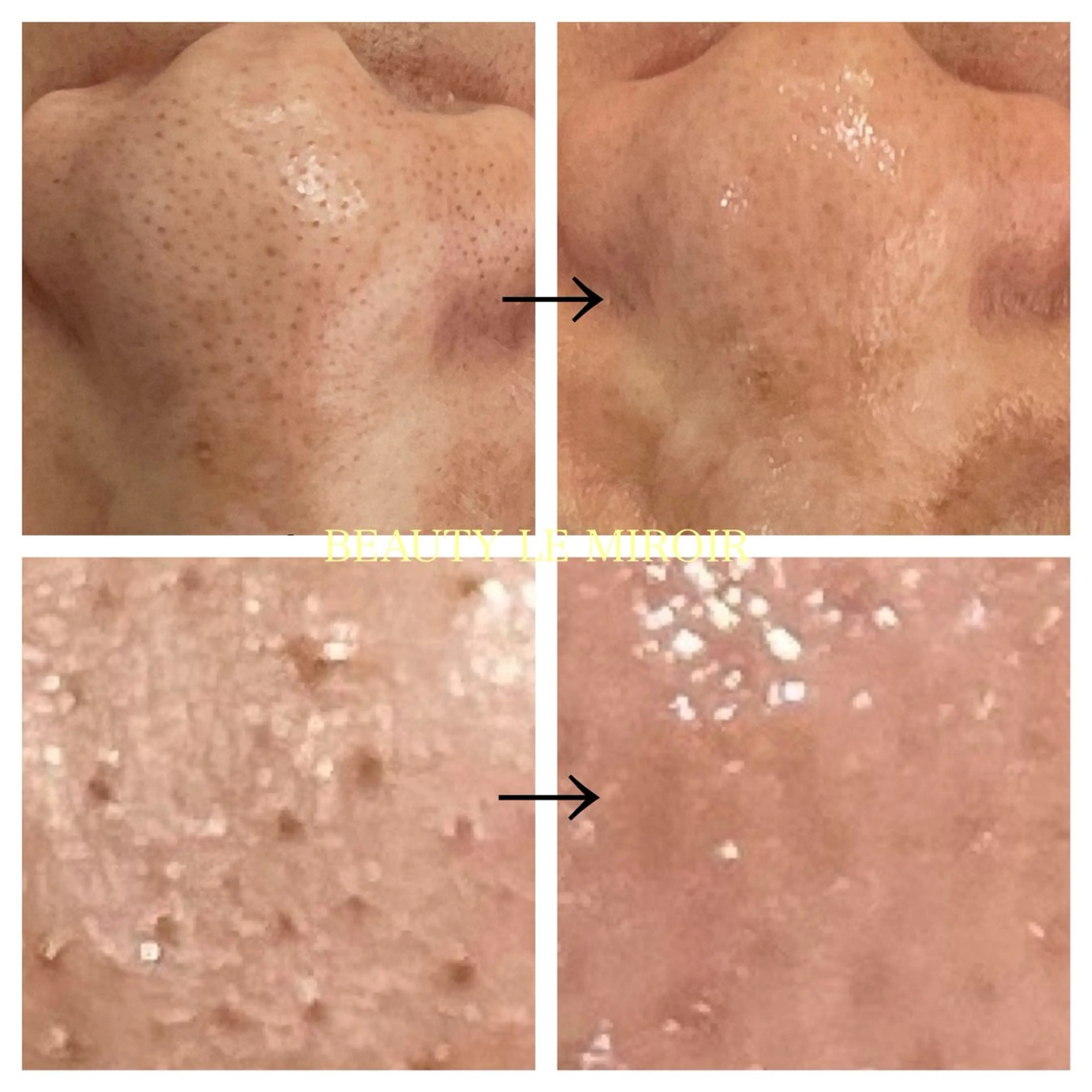 エステ ビューティー ミロワールのエステ・リラクイメージ