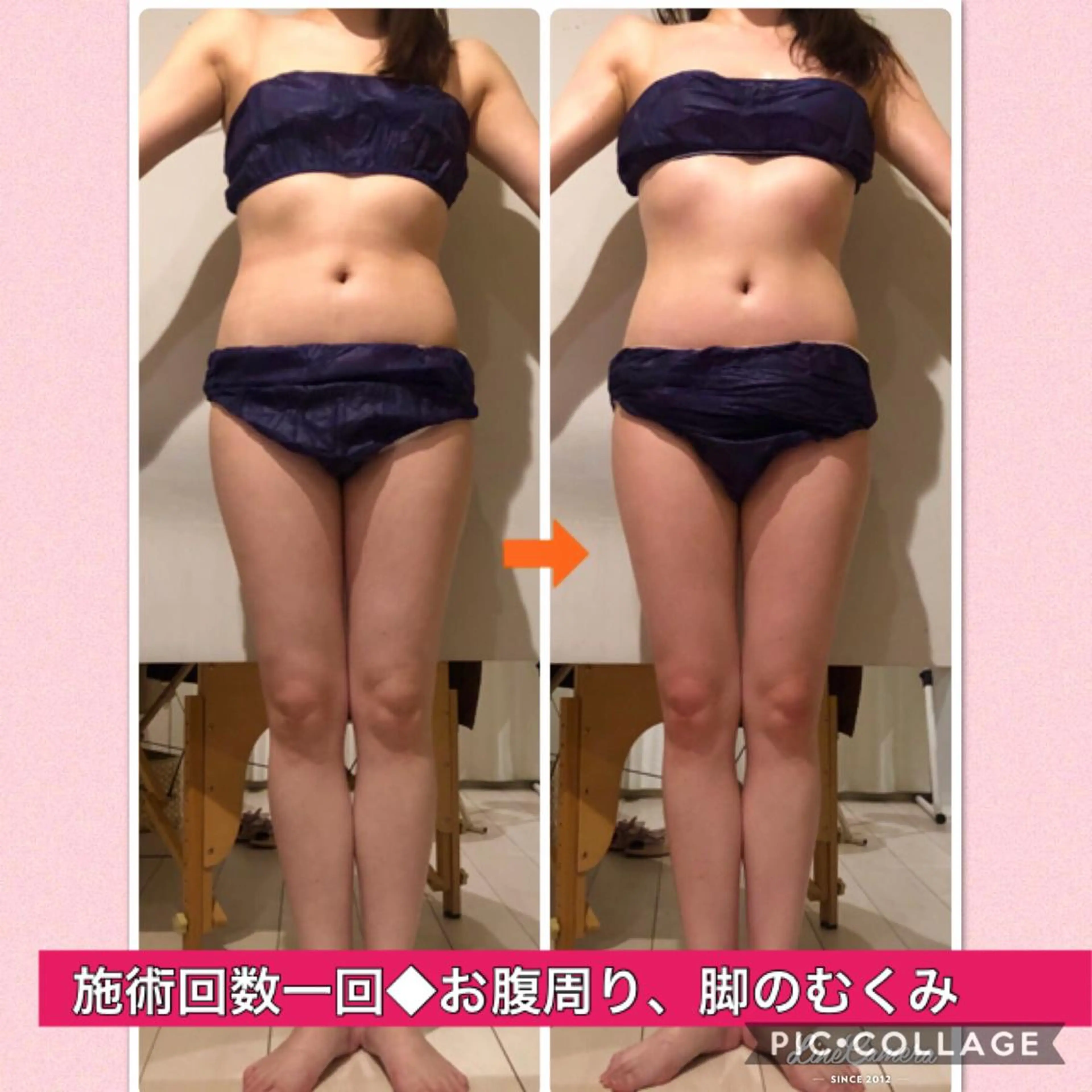 ショート カラー パーマ ヘアアレンジ メンズ キッズ ネイル マツエク・マツパ ‍痩身＆ボディ 結果出し🌟丹野のエステ・リラクイメージ