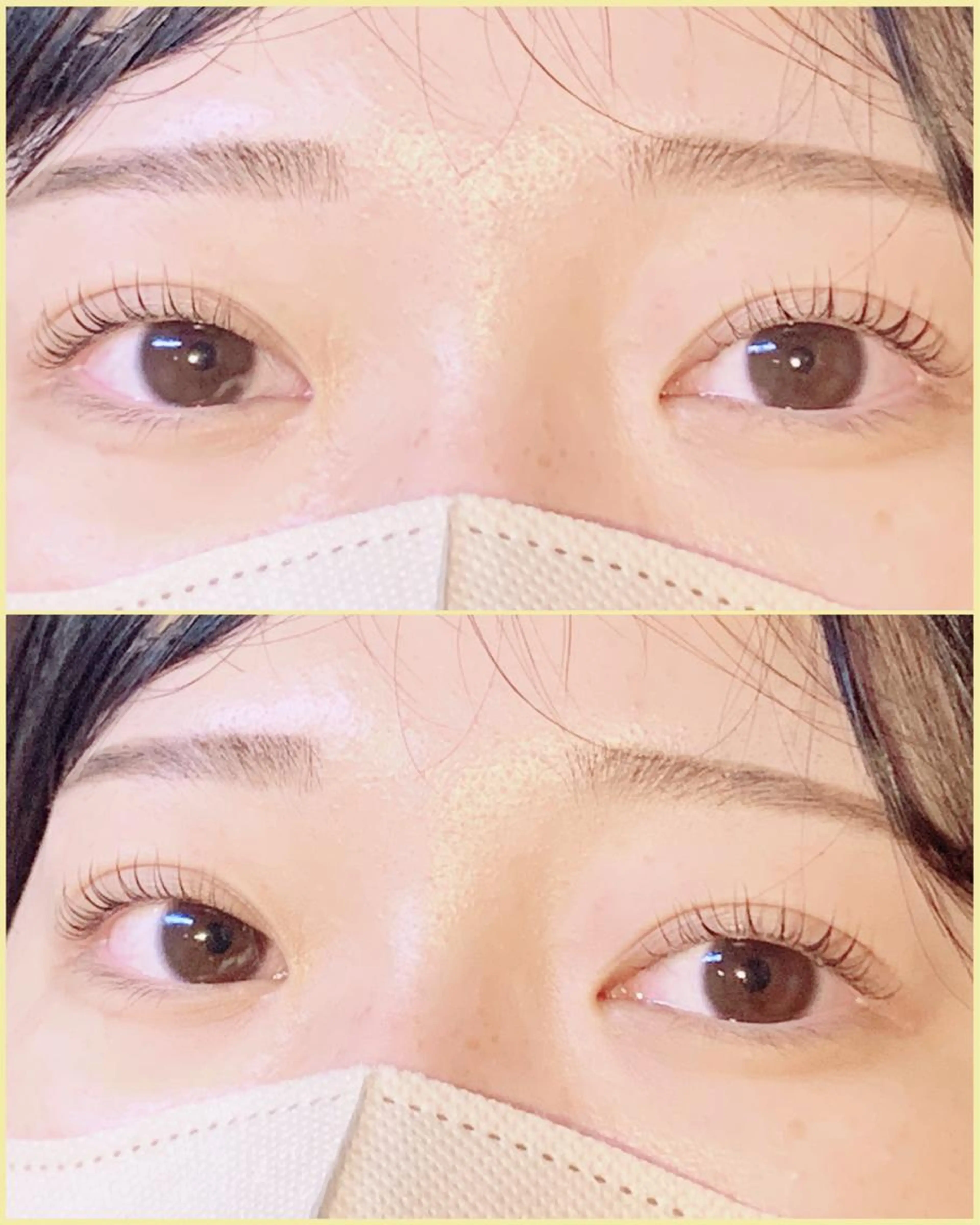 上マツパ+下マツパの写真