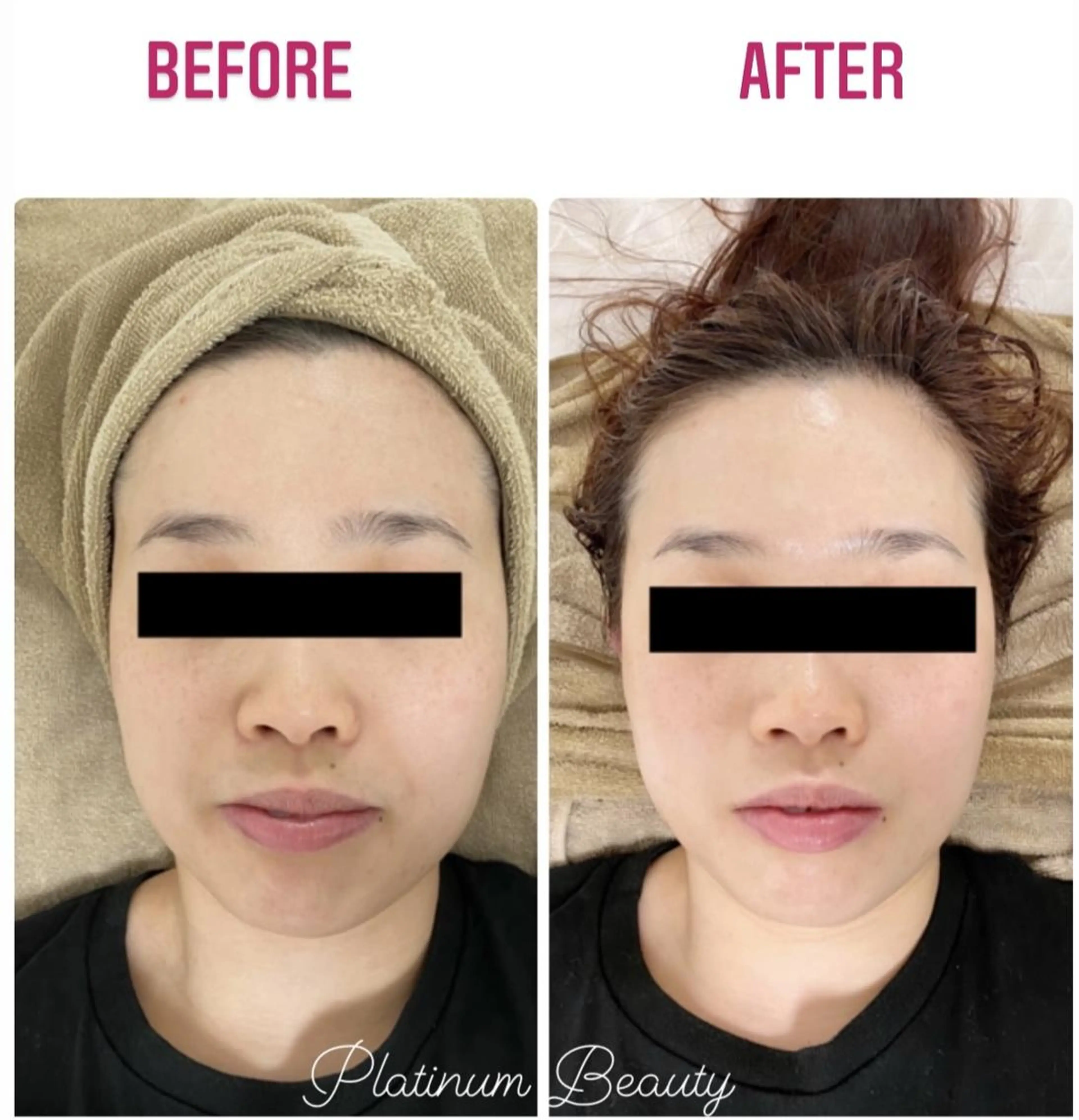 エステ プラティーヌ ボーテのその他イメージ