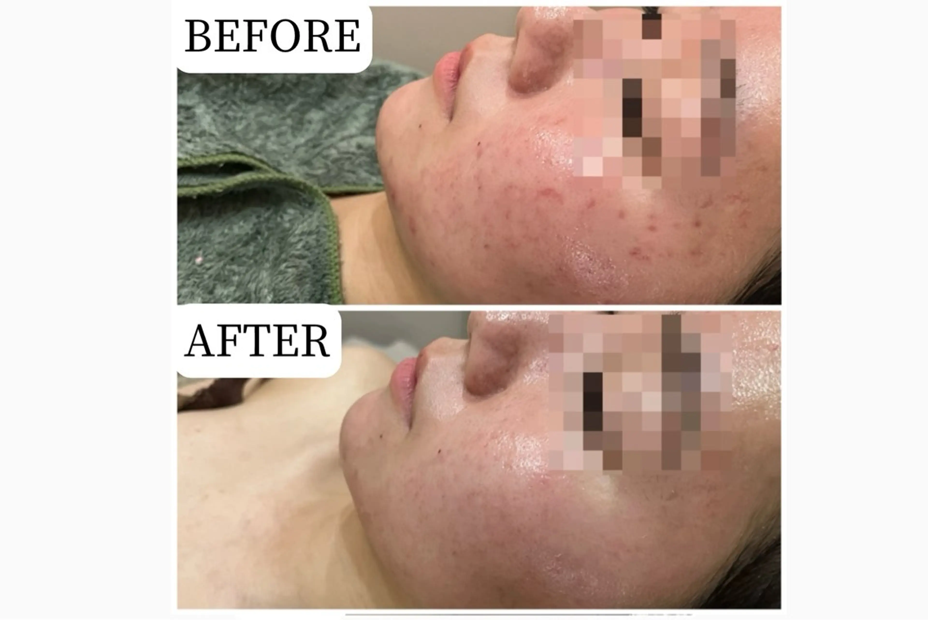 エステ 脱毛&フェイシャル 専門店muro.のエステ・リラクイメージ