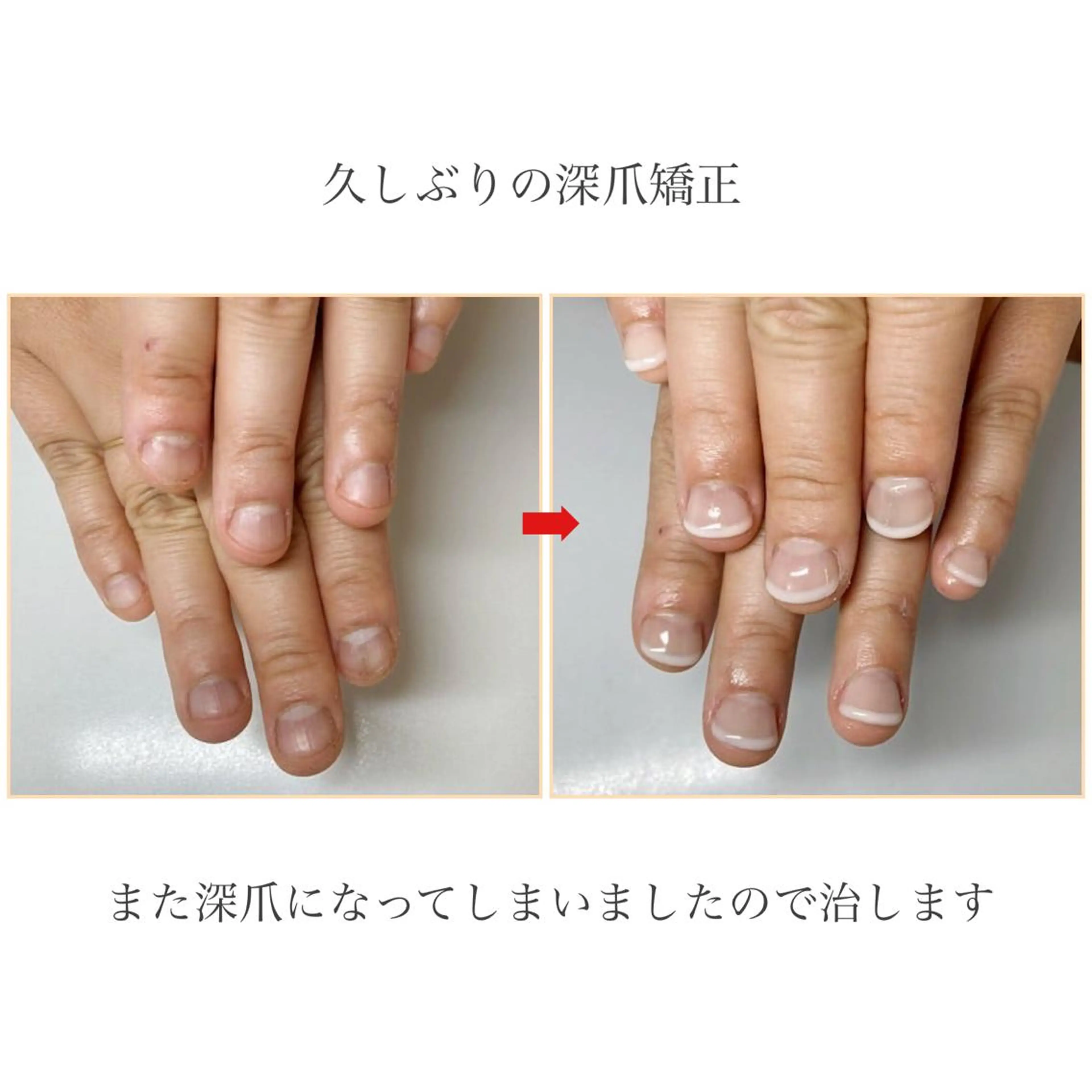 ネイル フレンチネイル ネイルサロン アリュームのネイルデザイン