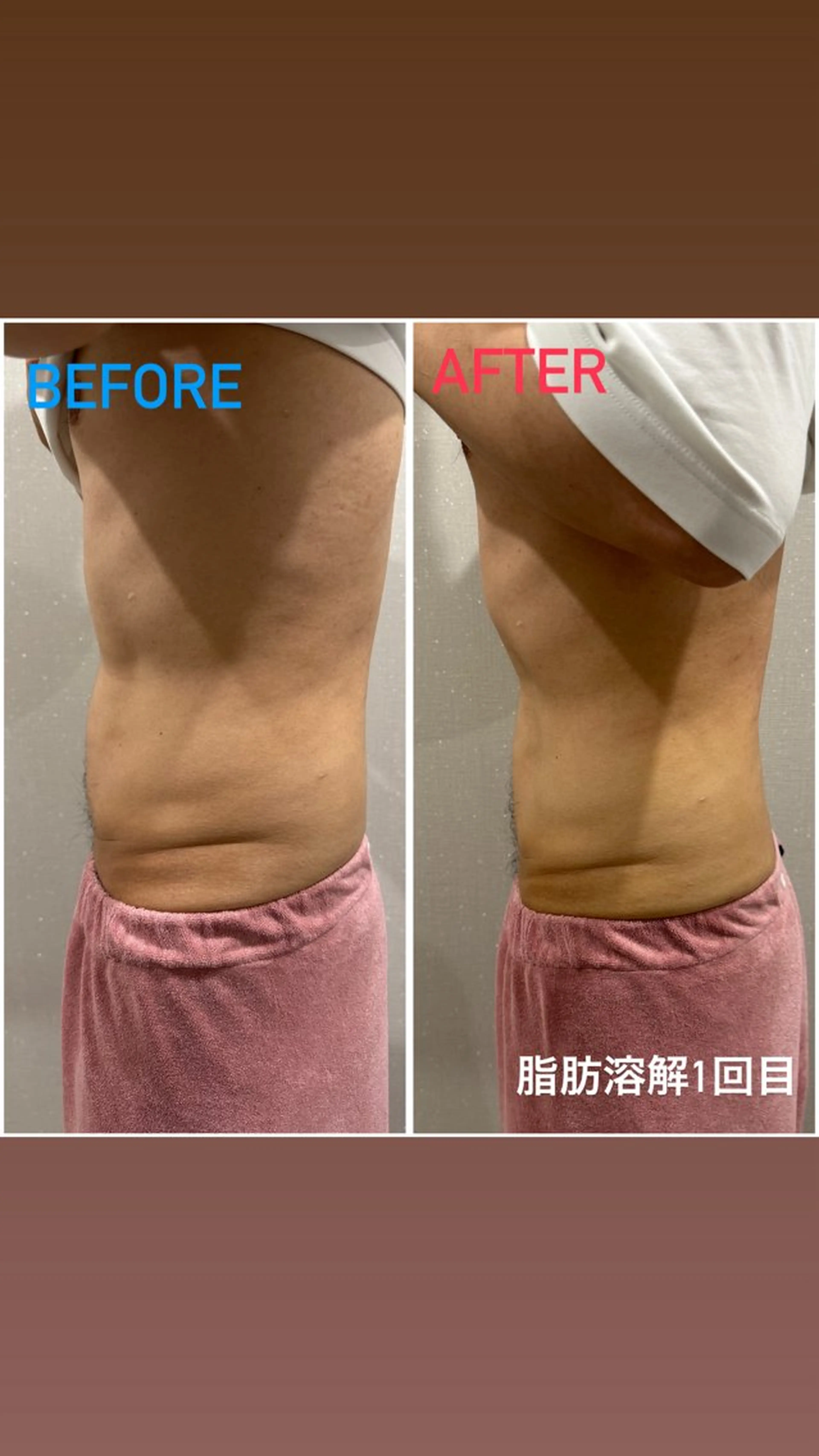 エステ 痩身/毛穴洗浄/脱毛 アルカンジュのエステ・リラクイメージ