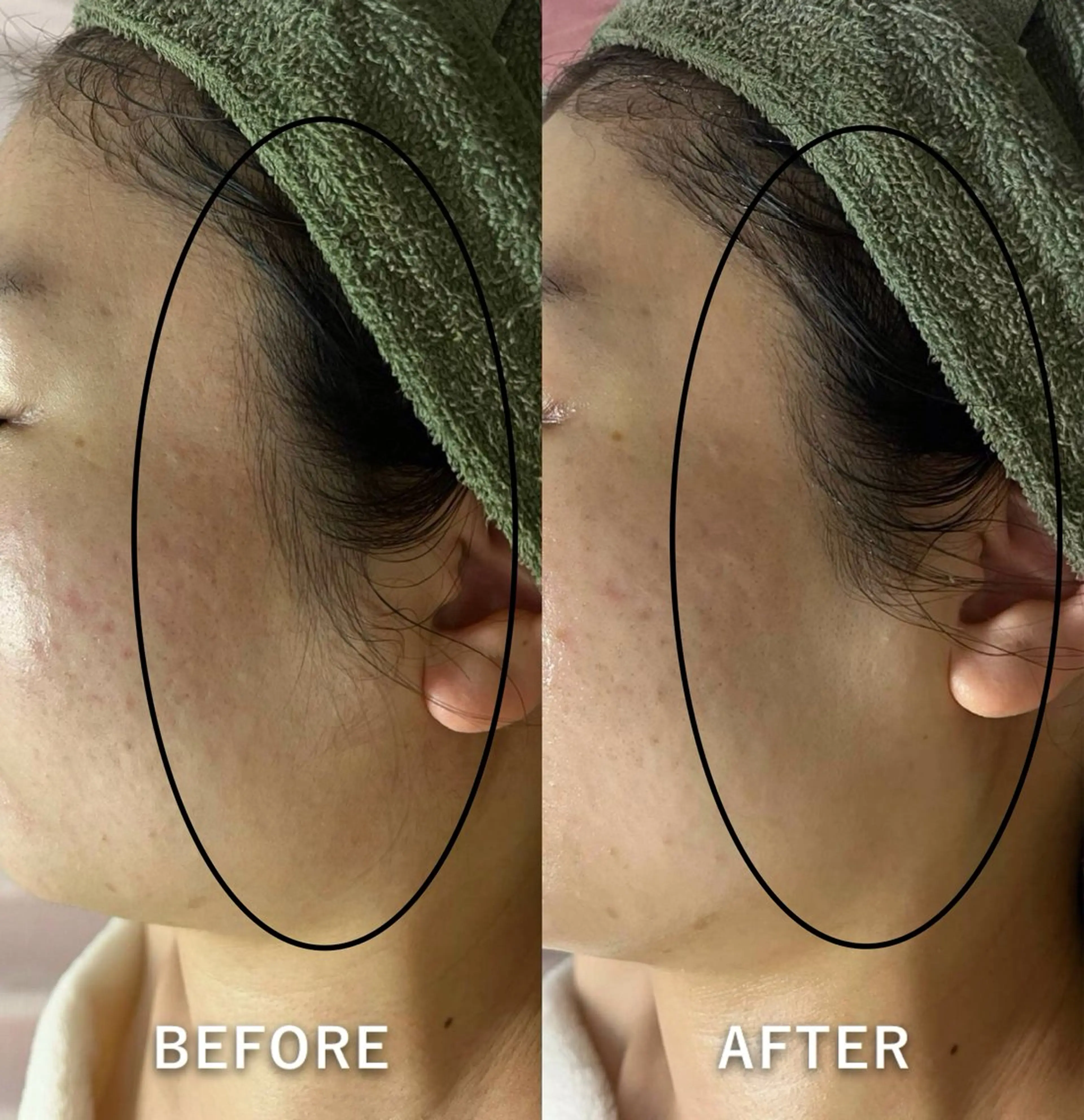 脱毛 salon de jessicaのエステ・リラクイメージ