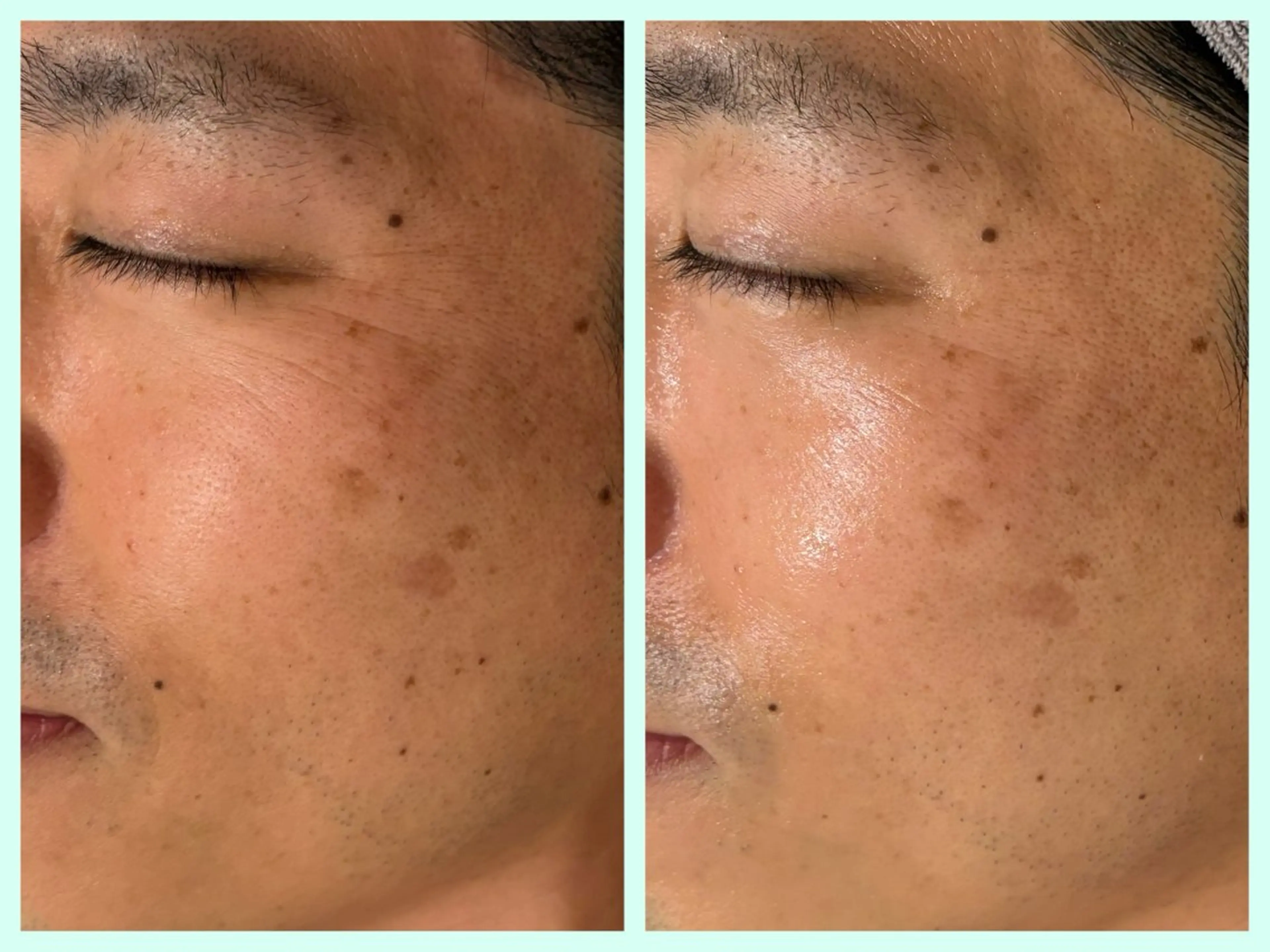 メンズ 小顔コルギ ☆表参道/外苑前のエステ・リラクイメージ