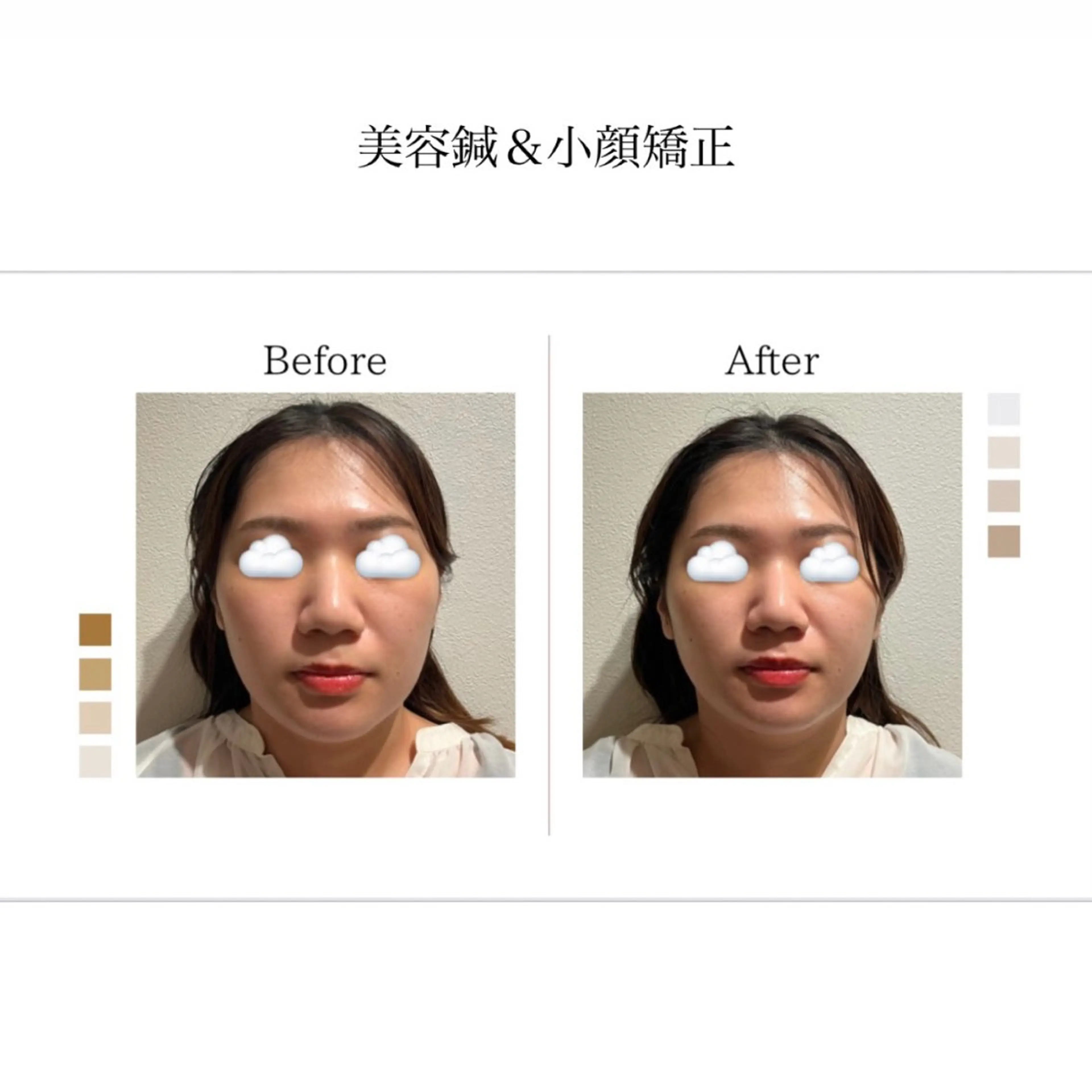 エステ リラク repos 鍼灸整骨院のエステ・リラクイメージ