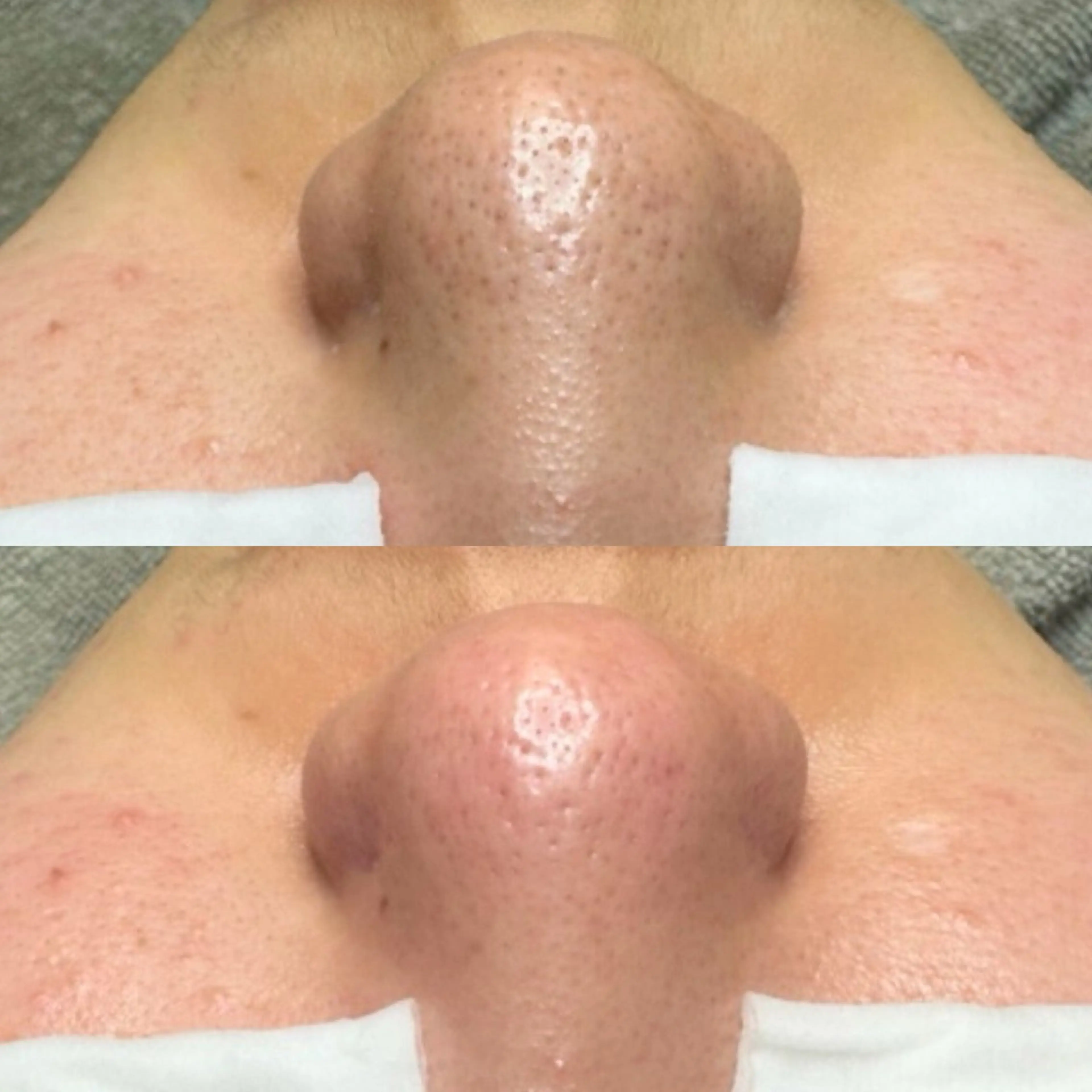 エステ 毛穴ケア特化専門店 トネア自由が丘店のエステ・リラクイメージ