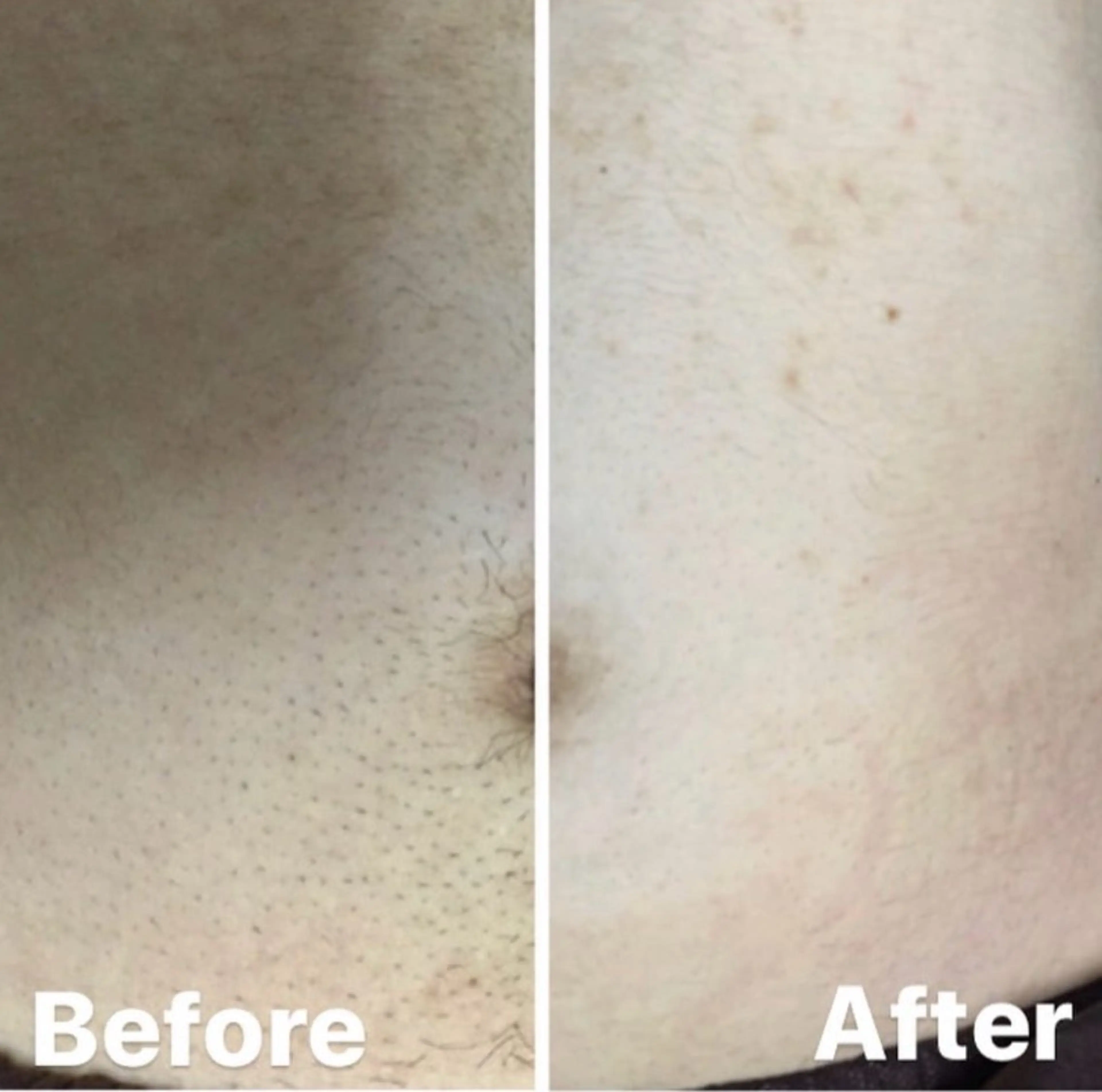 脱毛 RILsalon 脱毛/フェイシャルのエステ・リラクイメージ